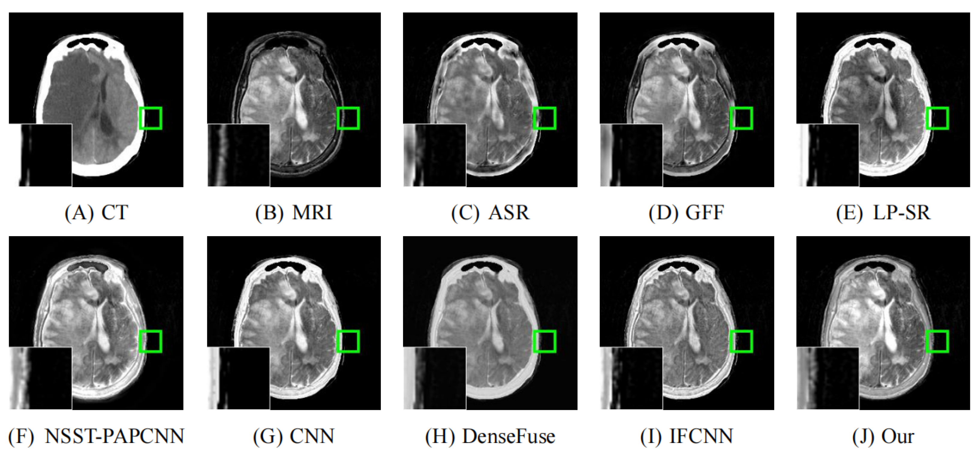 Entropy 24 00843 g011 550