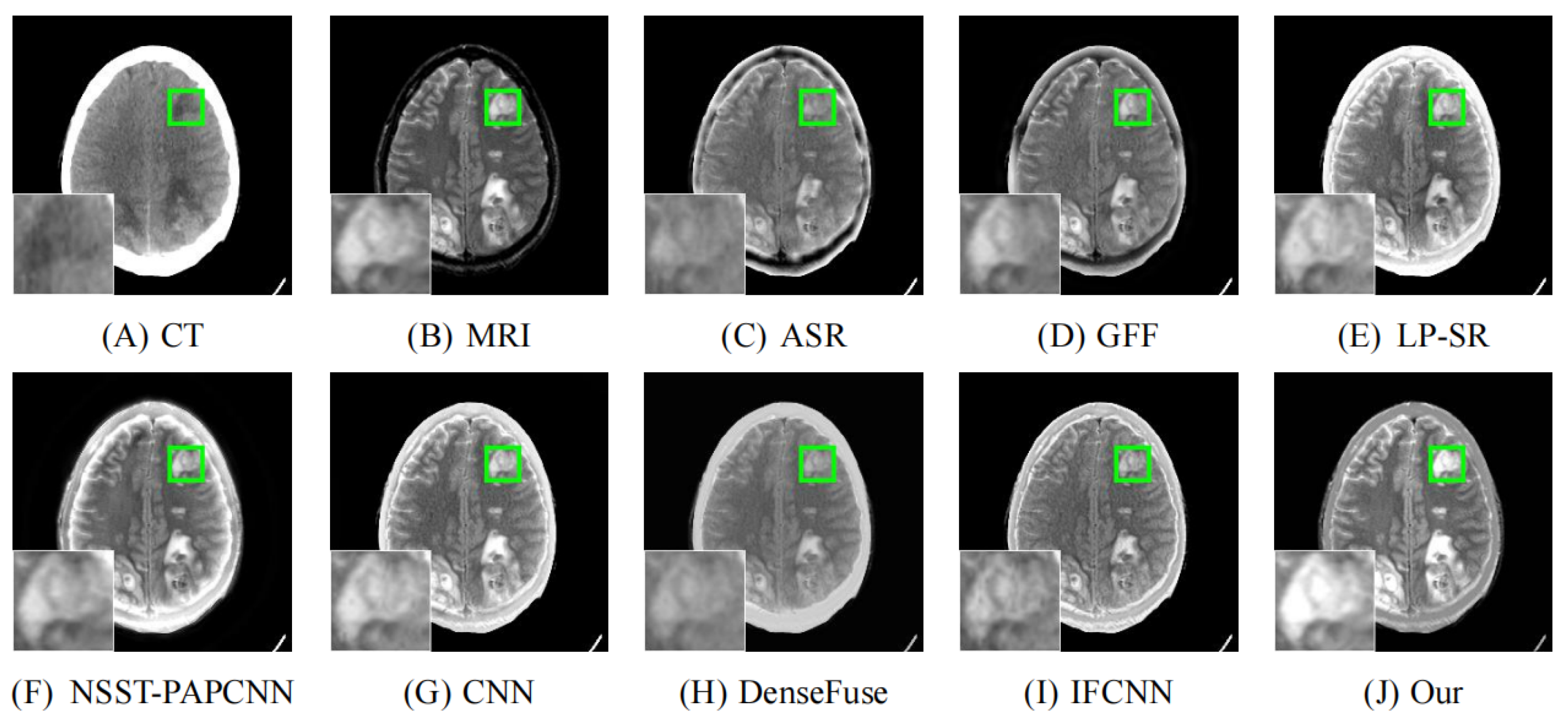 Entropy 24 00843 g012 550