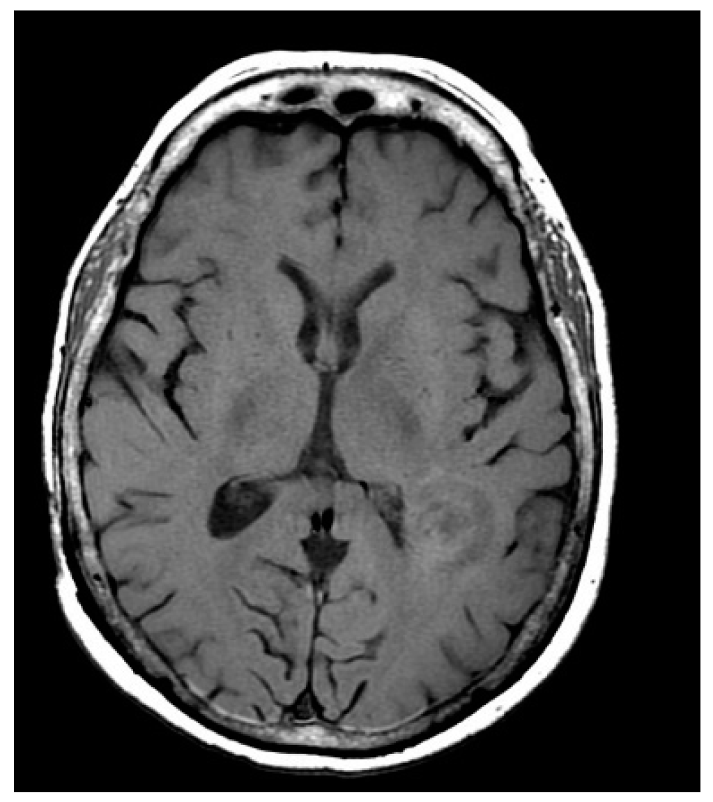 Entropy 24 00869 g001