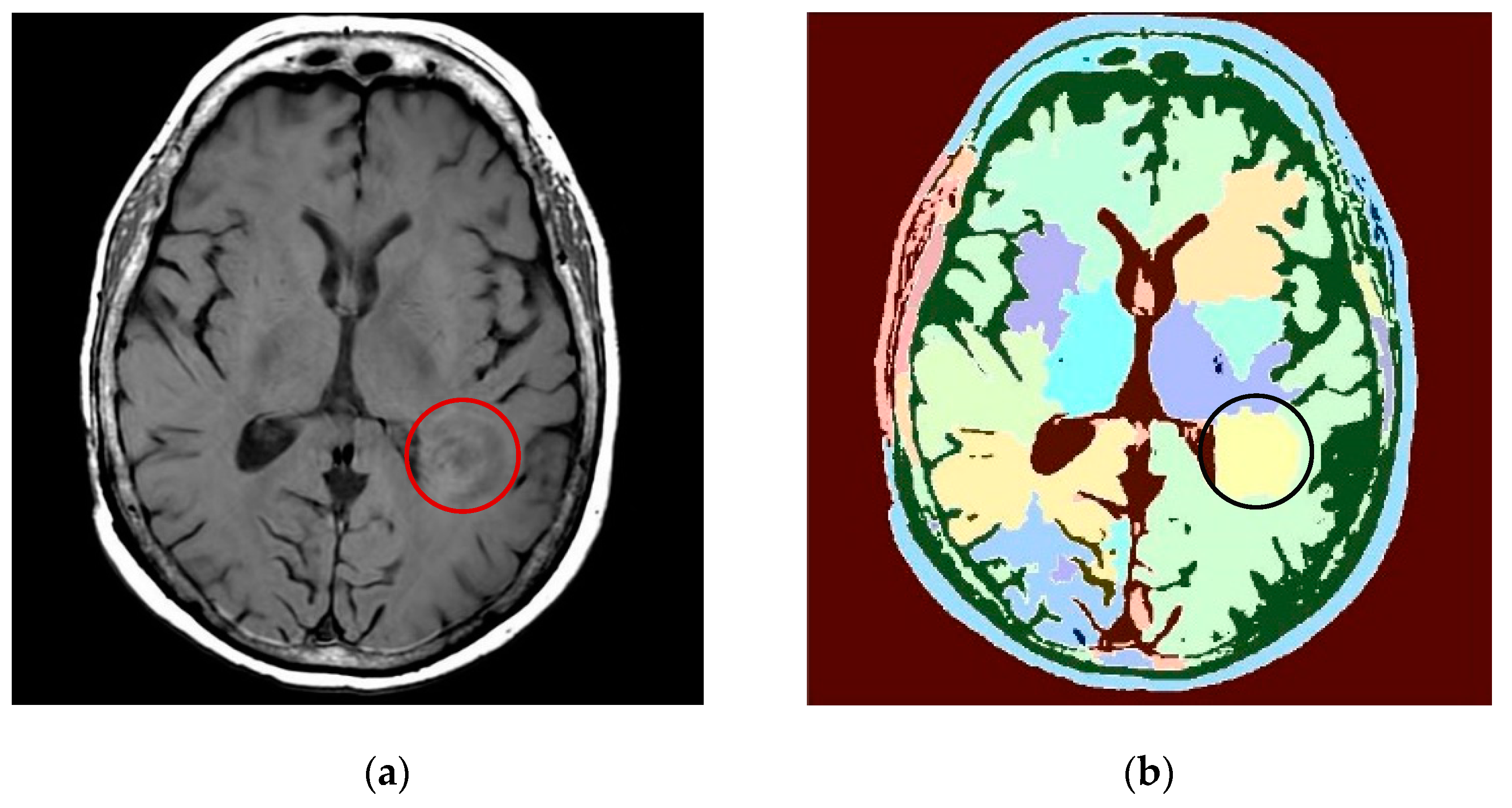Entropy 24 00869 g011