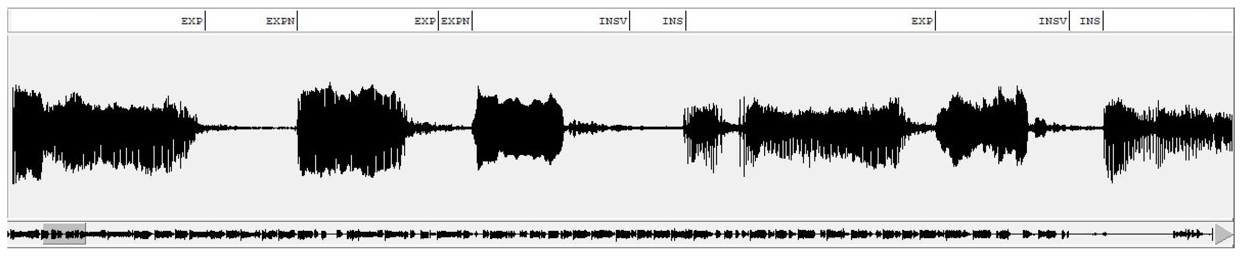 Entropy 24 01194 g002 550