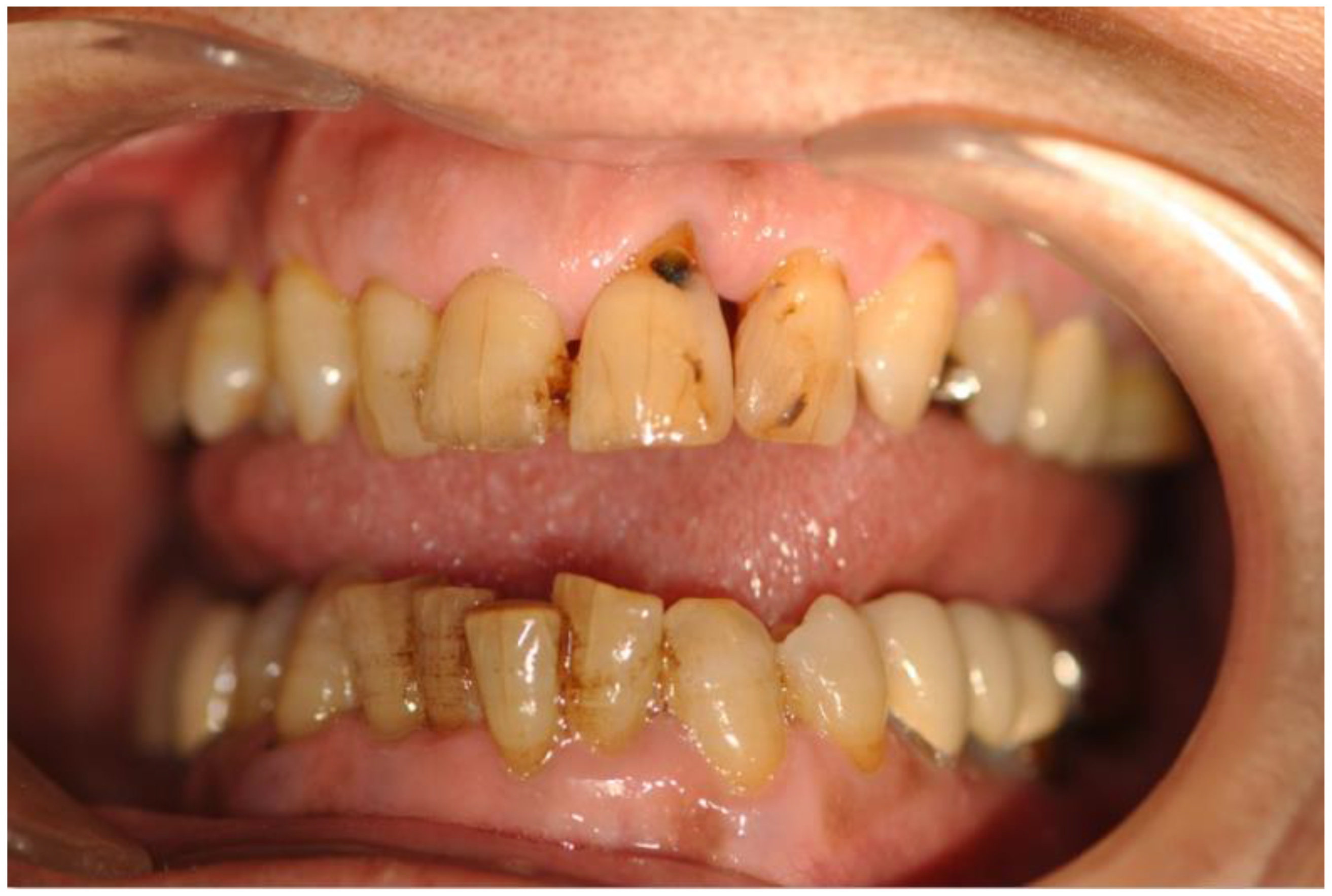 Entropy 24 01358 g001