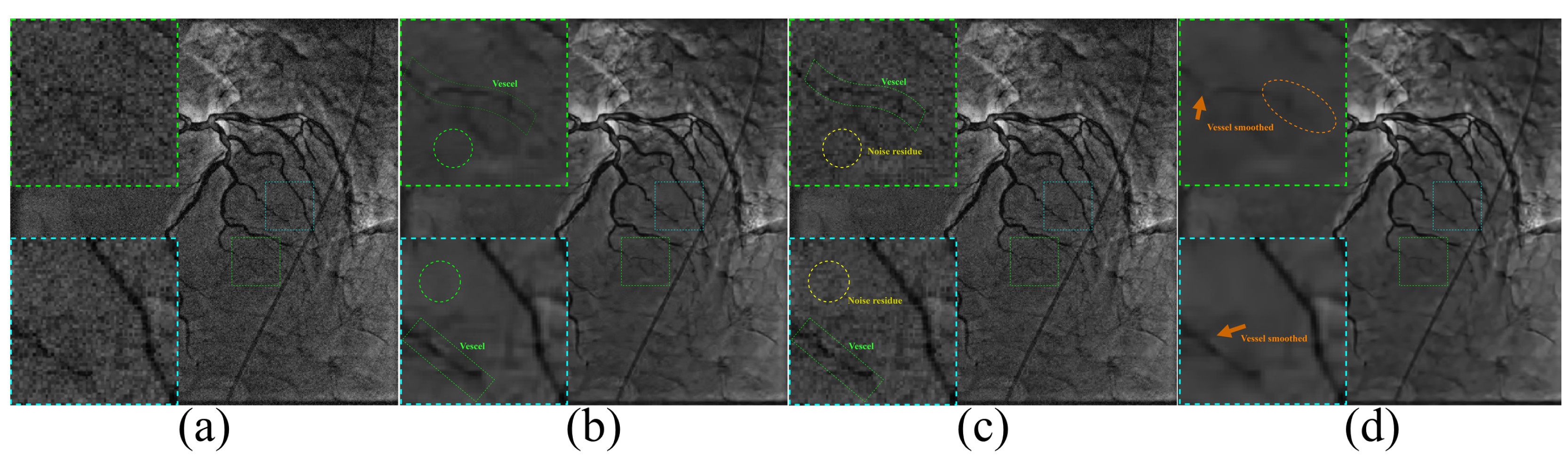 Entropy 24 01518 g011 Entropy 24 01518 g011