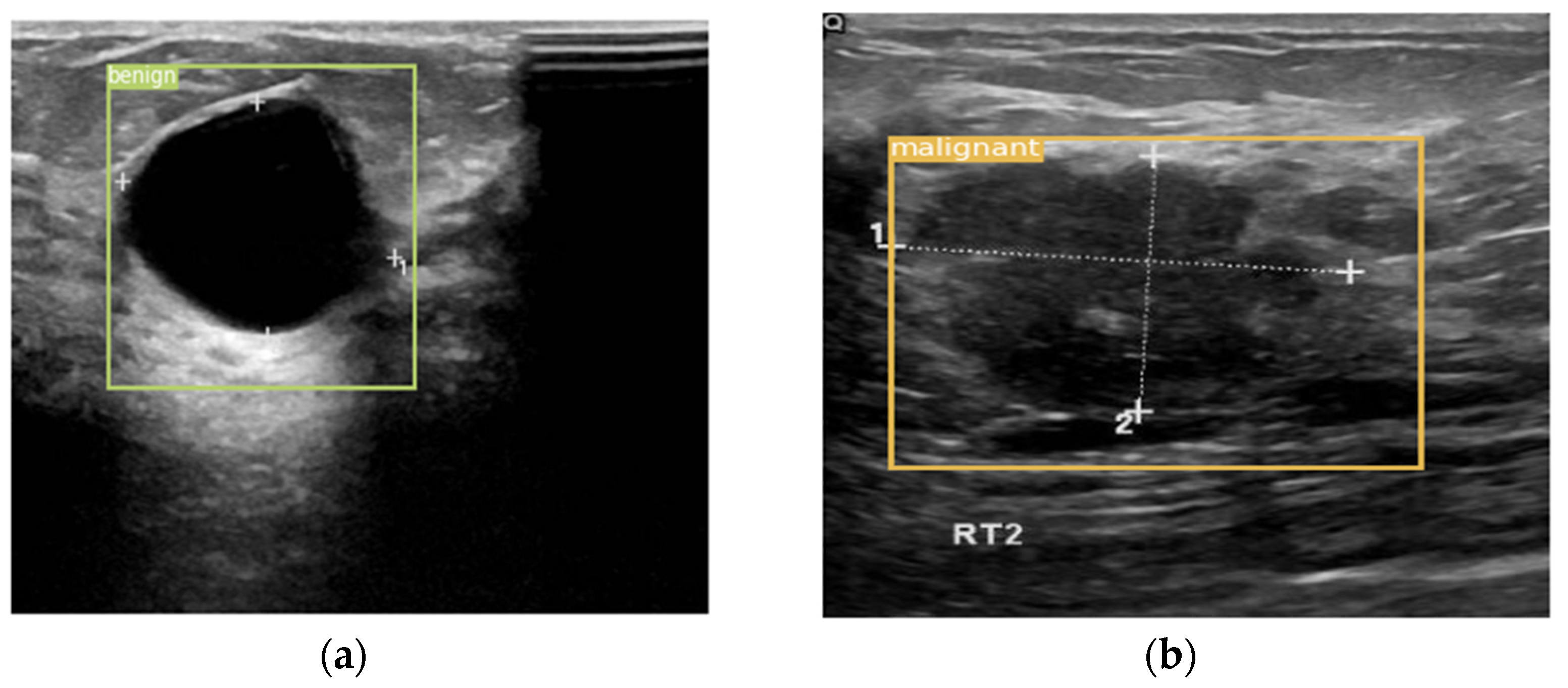 Entropy 24 01543 g010
