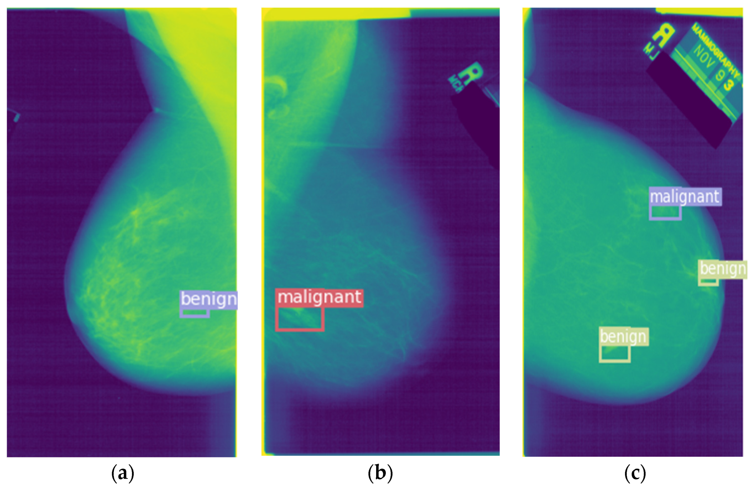 Entropy 24 01543 g011