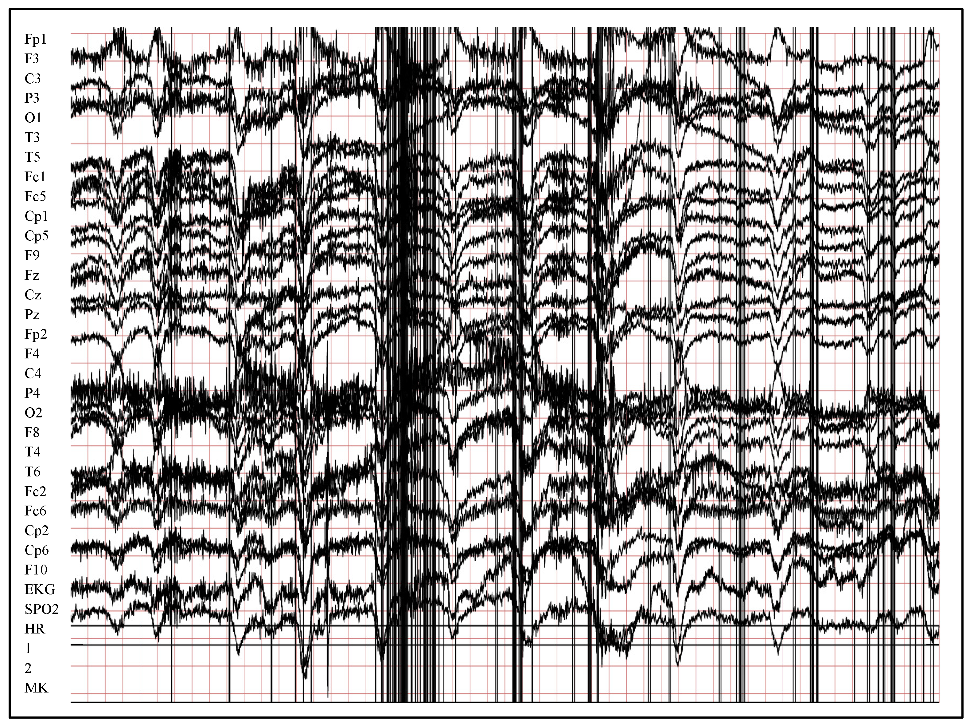 Entropy 24 01641 g004 Entropy 24 01641 g004
