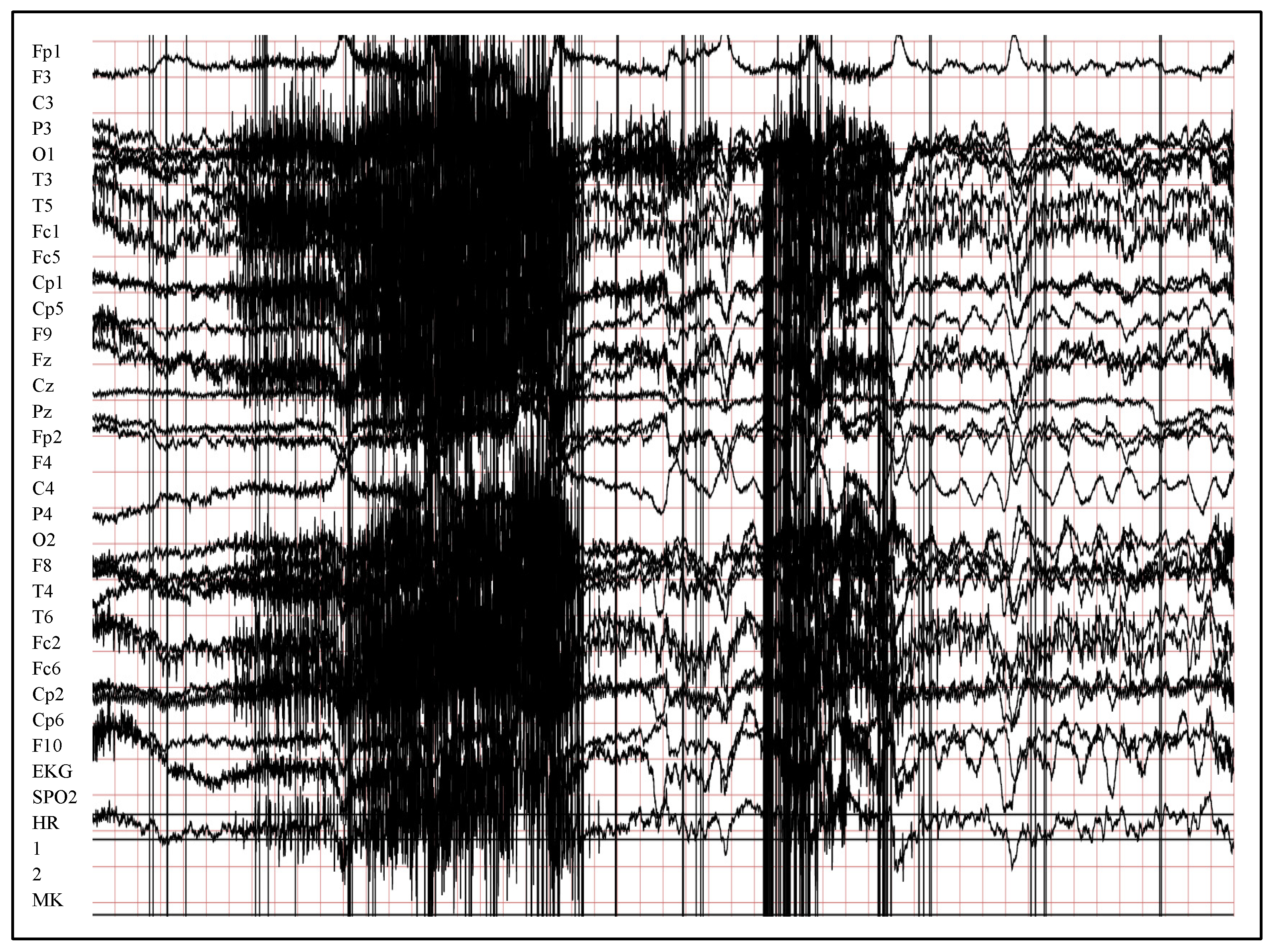 Entropy 24 01641 g005 Entropy 24 01641 g005