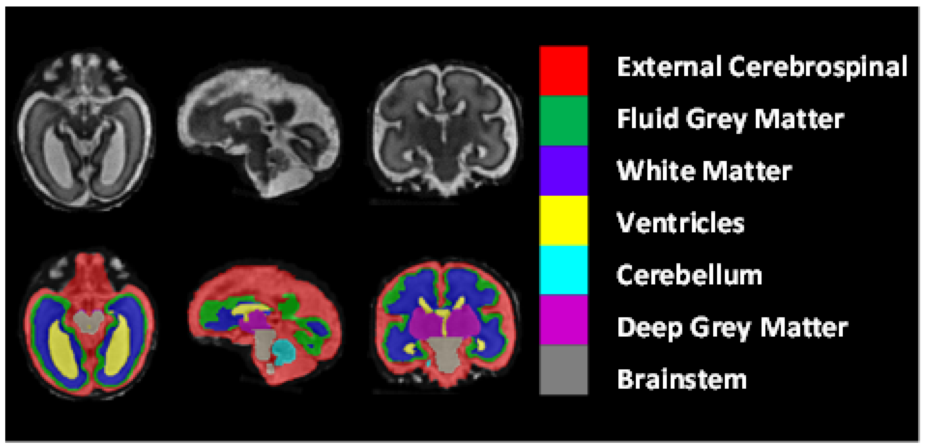 Entropy 24 01708 g008