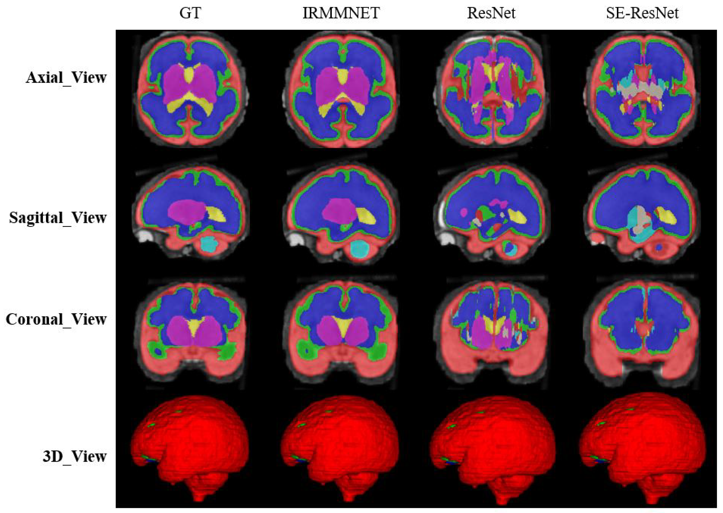 Entropy 24 01708 g010