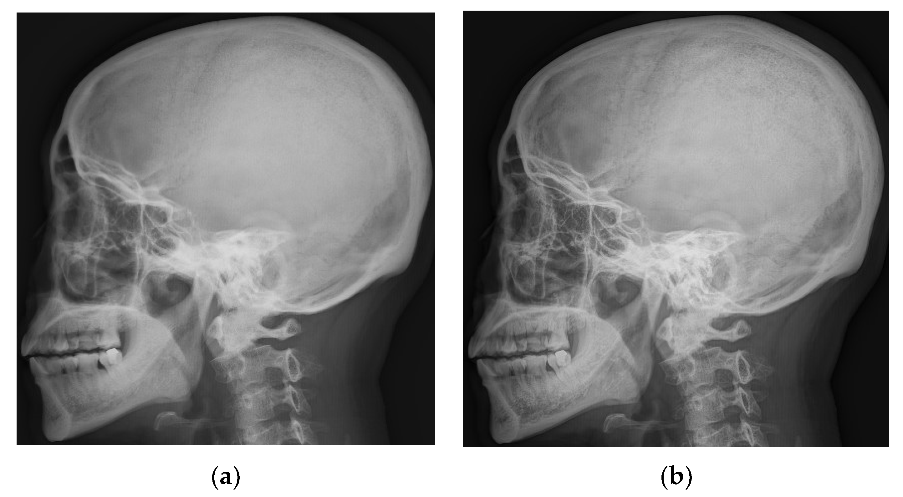 Entropy 24 01754 g009 Entropy 24 01754 g009