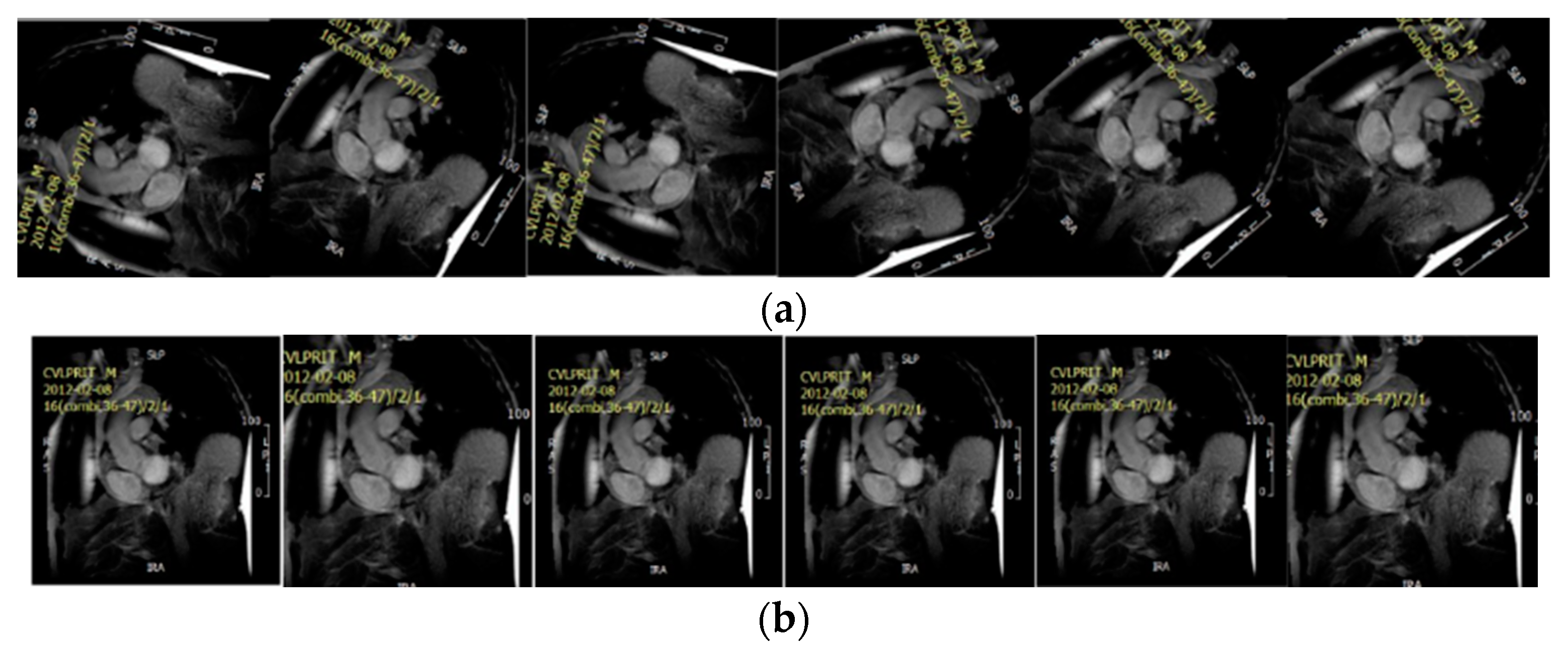 Entropy 25 00431 g010 Entropy 25 00431 g010