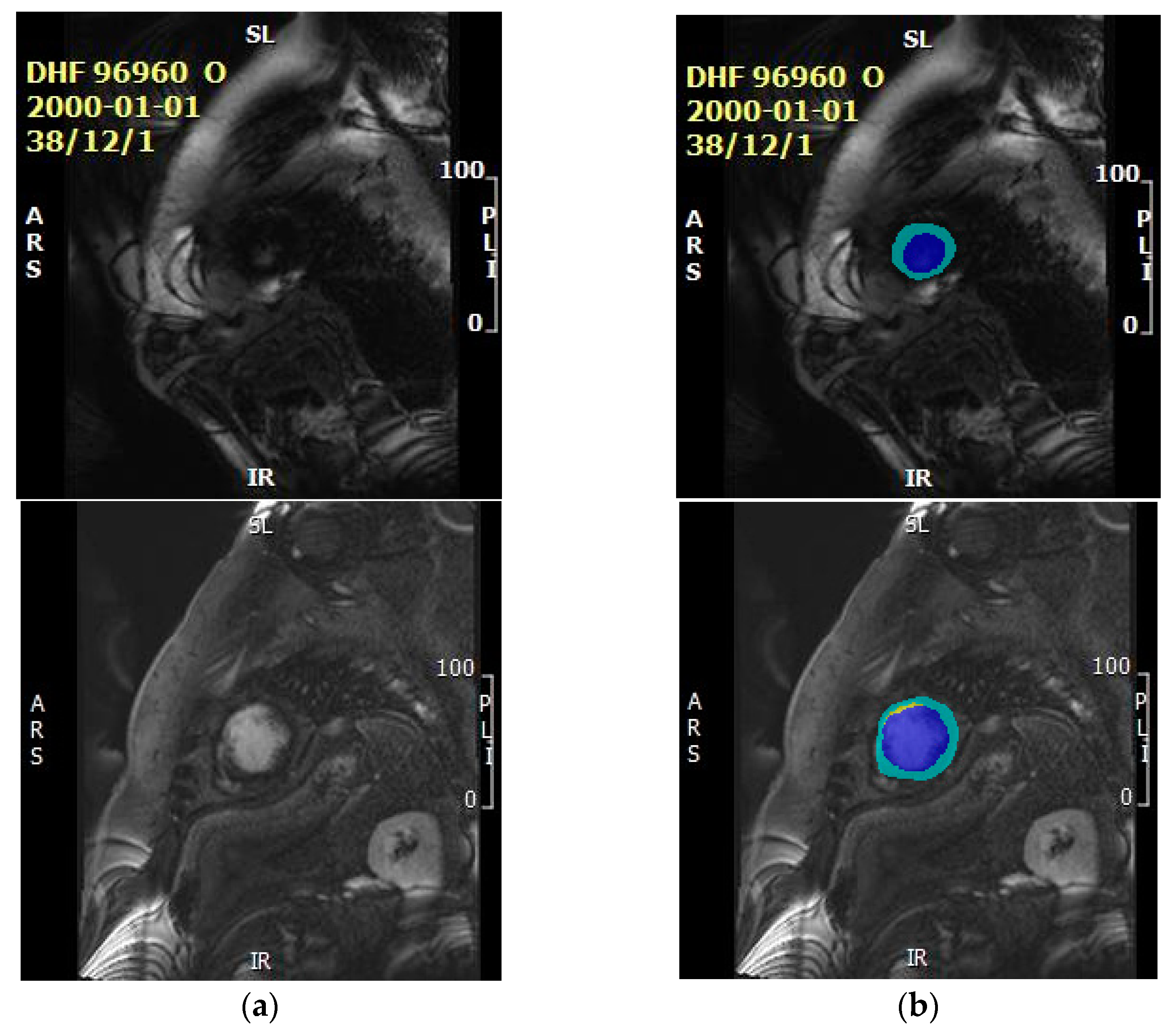 Entropy 25 00431 g011 Entropy 25 00431 g011