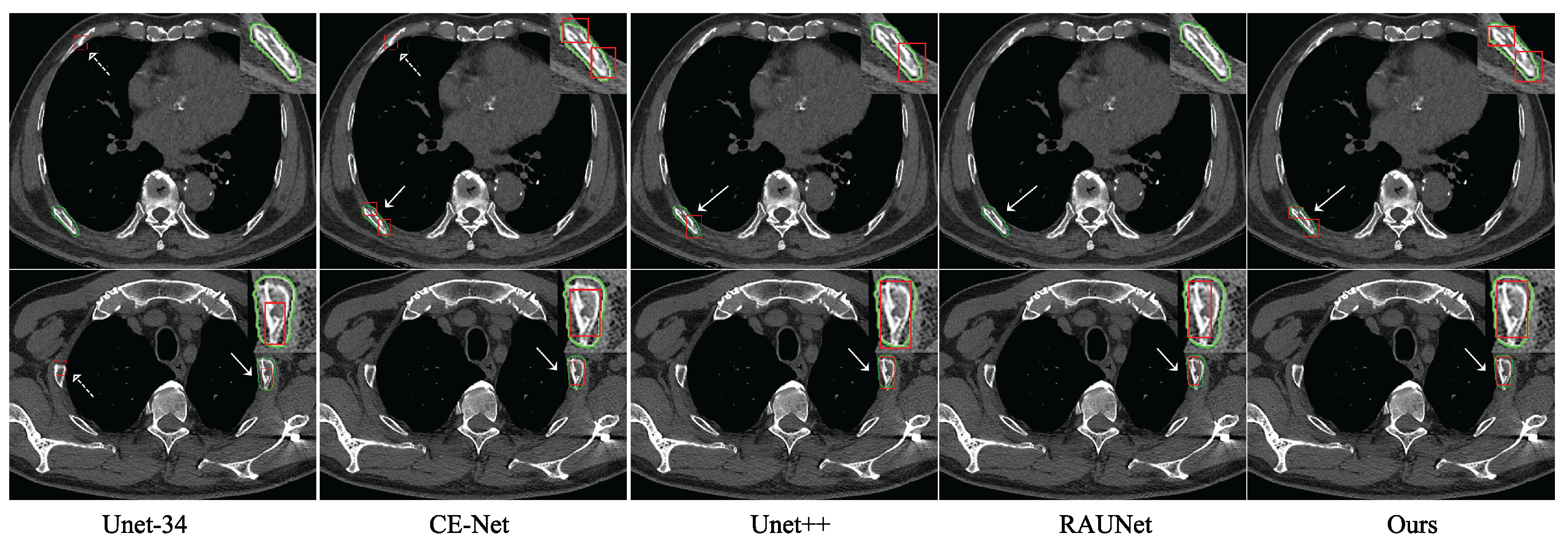 Entropy 25 00466 g005 Entropy 25 00466 g005