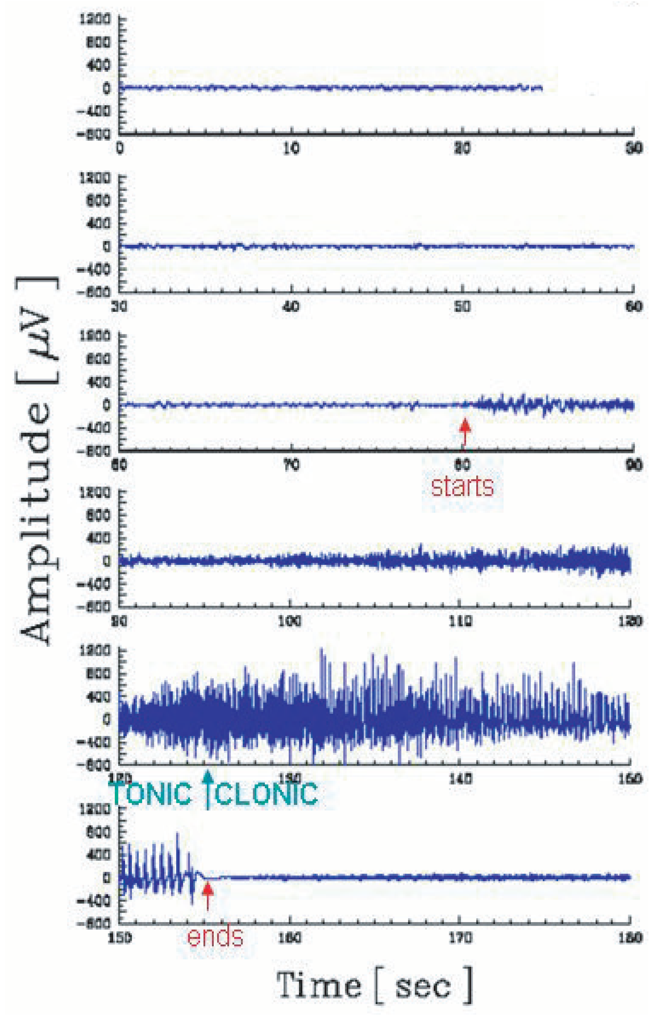 Entropy 25 00578 g007