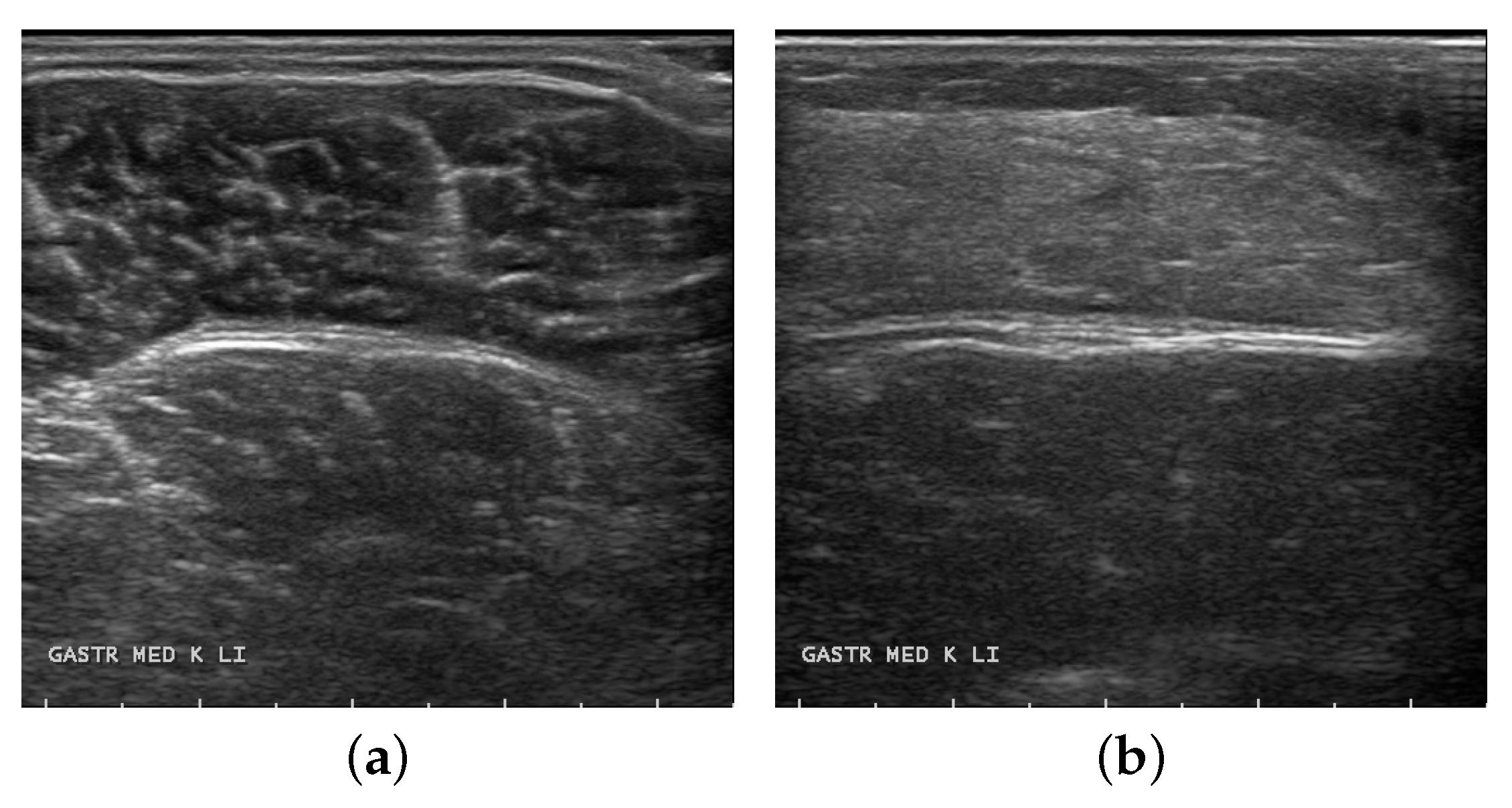 Entropy 25 00662 g005 Entropy 25 00662 g005