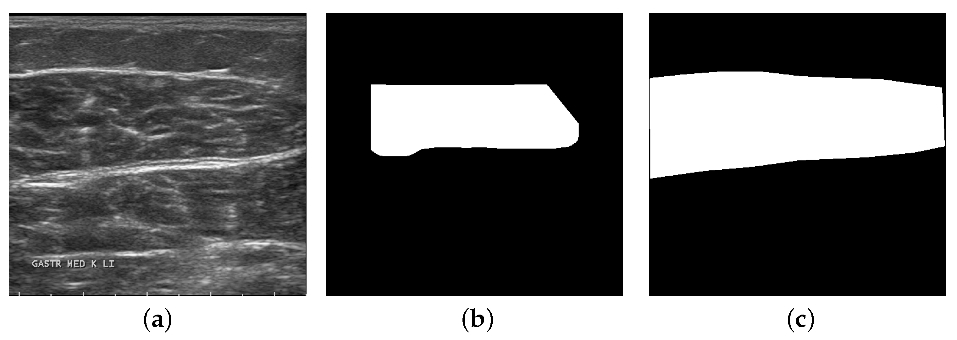 Entropy 25 00662 g006 Entropy 25 00662 g006