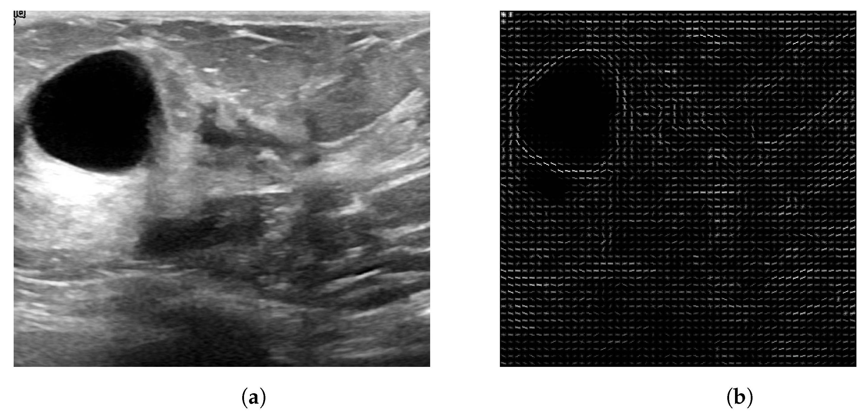 Entropy 25 00991 g010