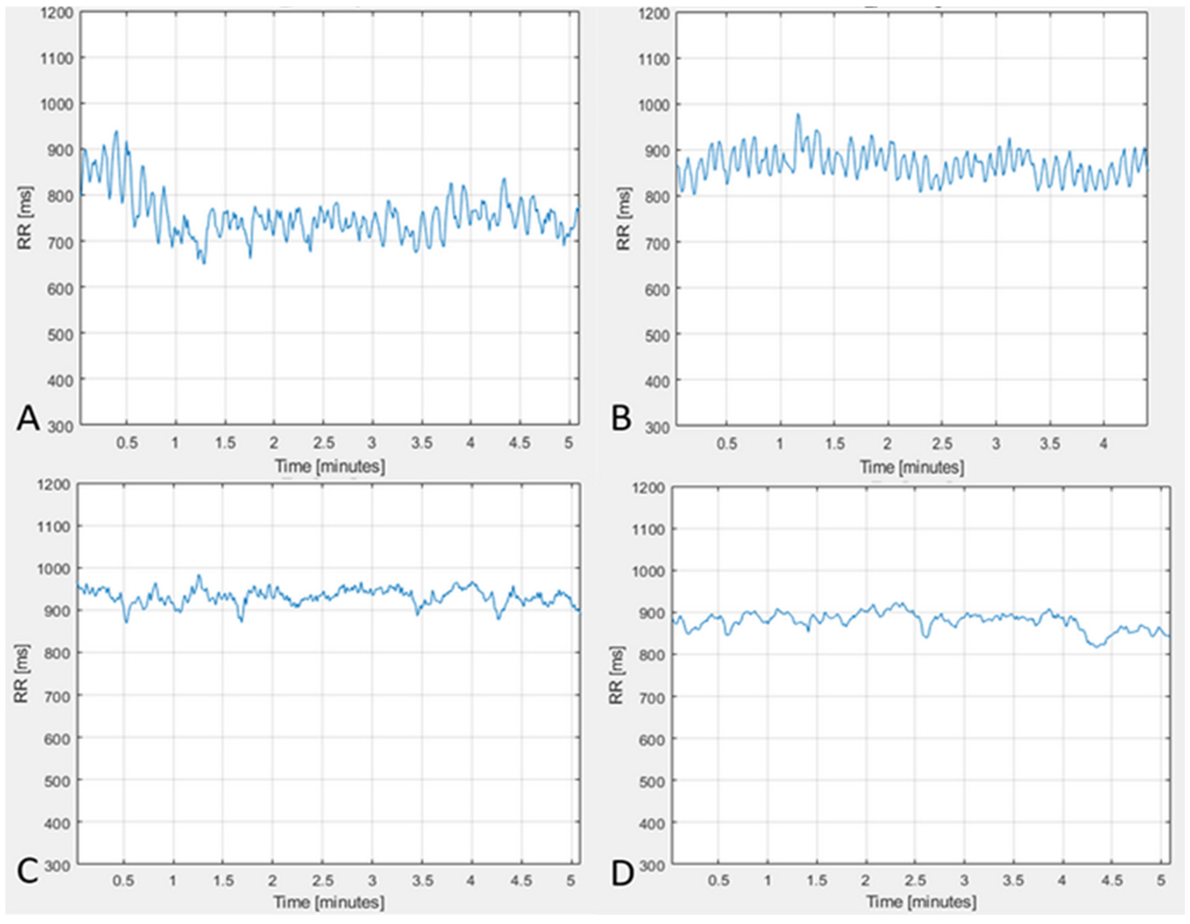 Entropy 25 01023 g004