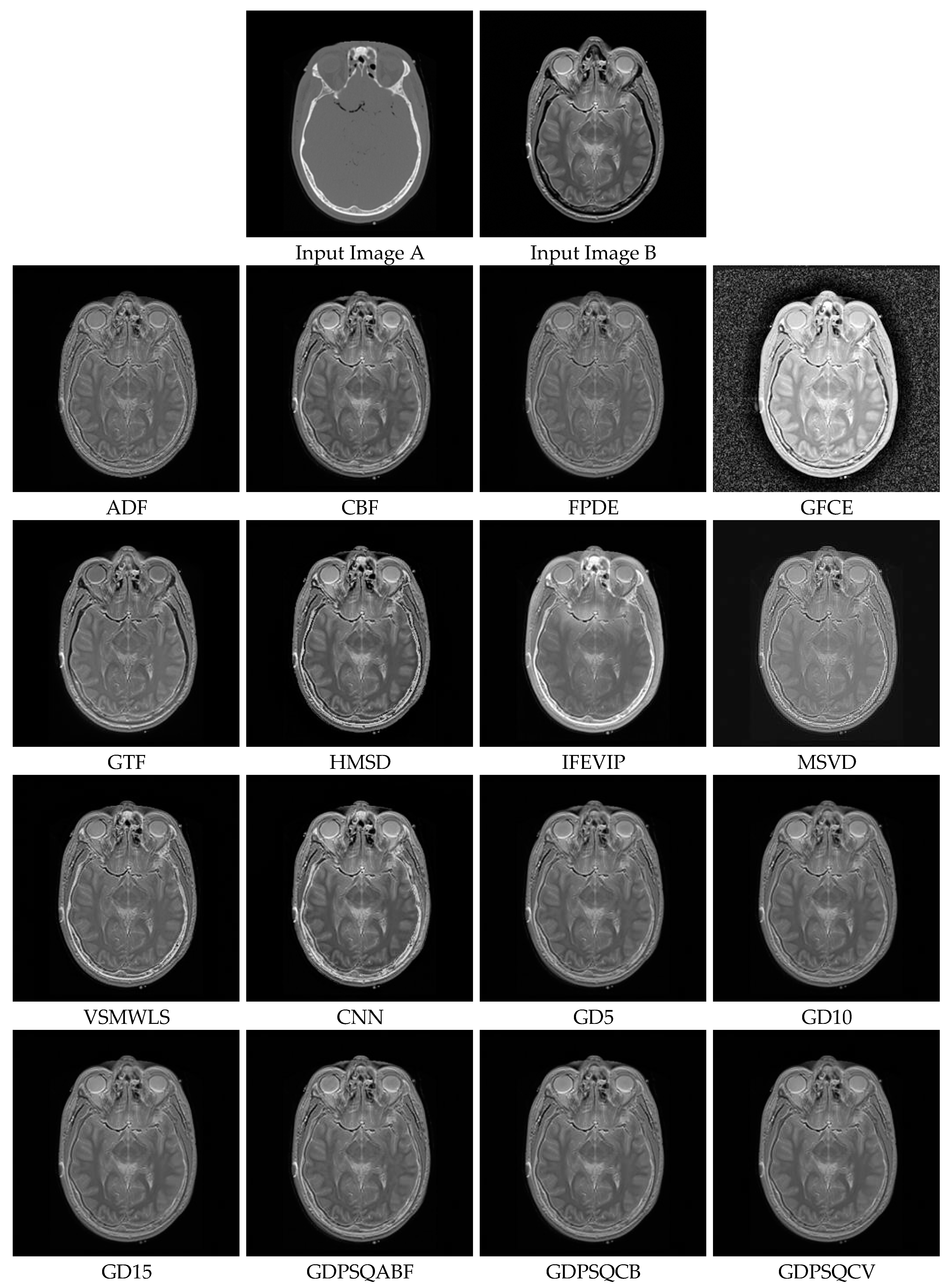 Entropy 25 01215 g013