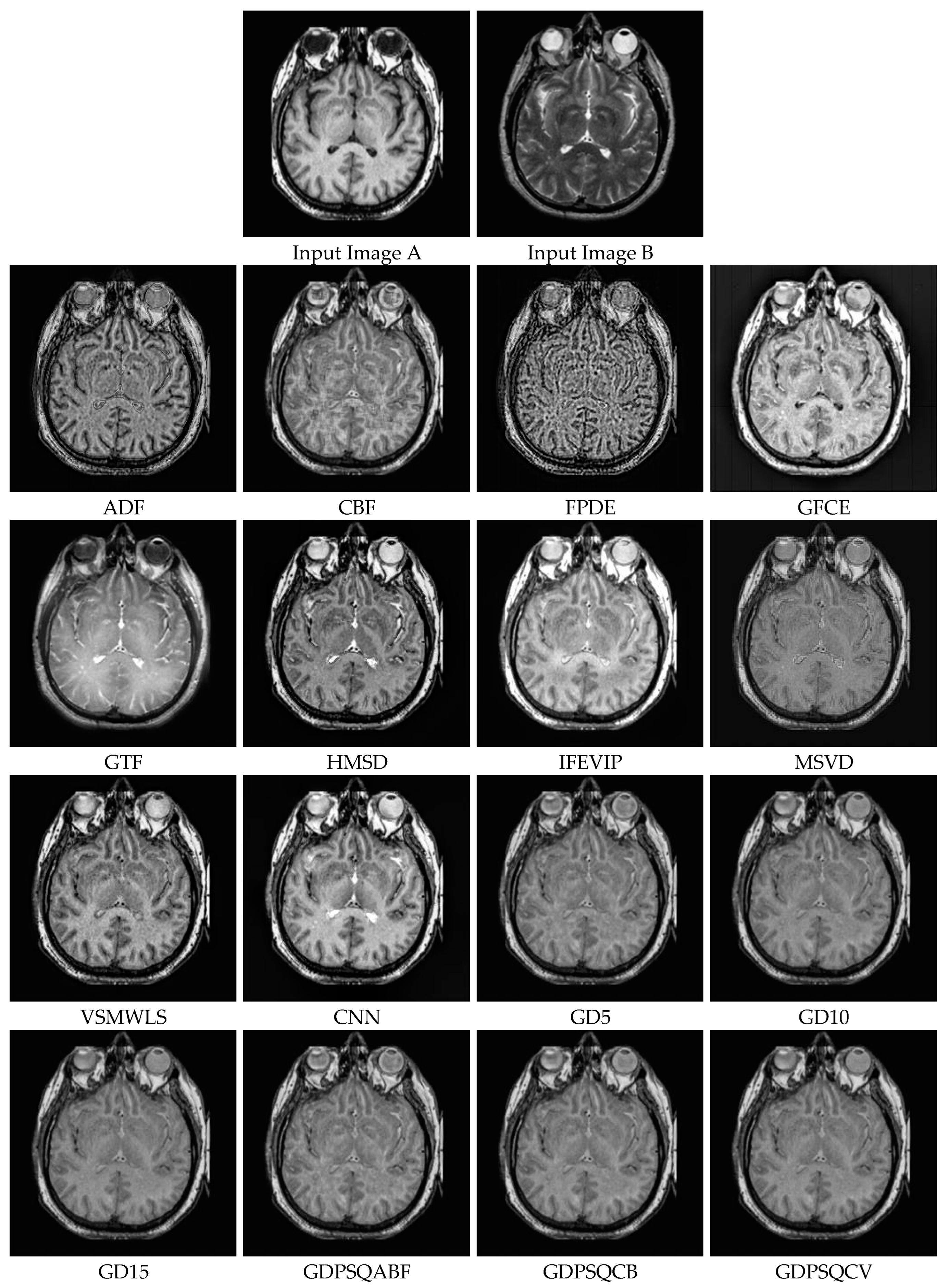 Entropy 25 01215 g014