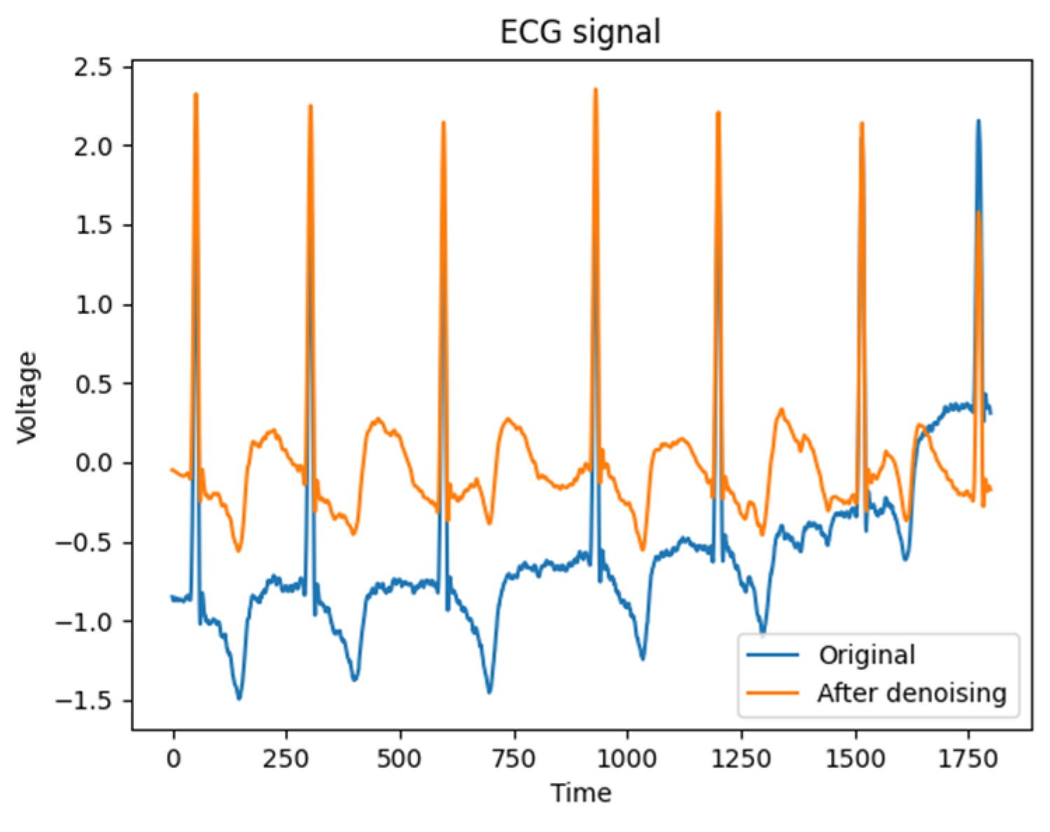 Entropy | Free Full-Text | Deep Learning Modeling of Cardiac Arrhythmia ...