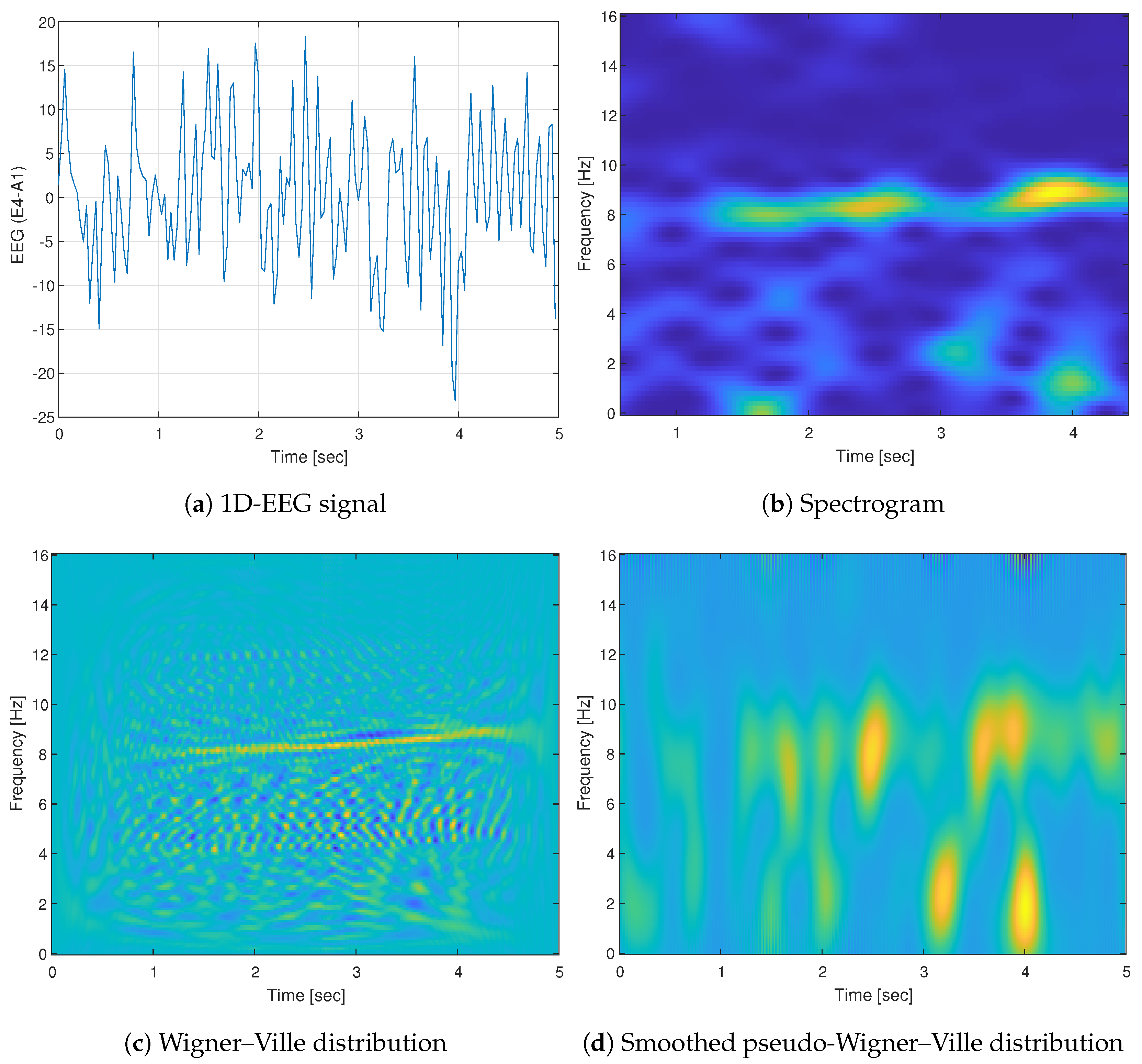 Entropy 25 01395 g005