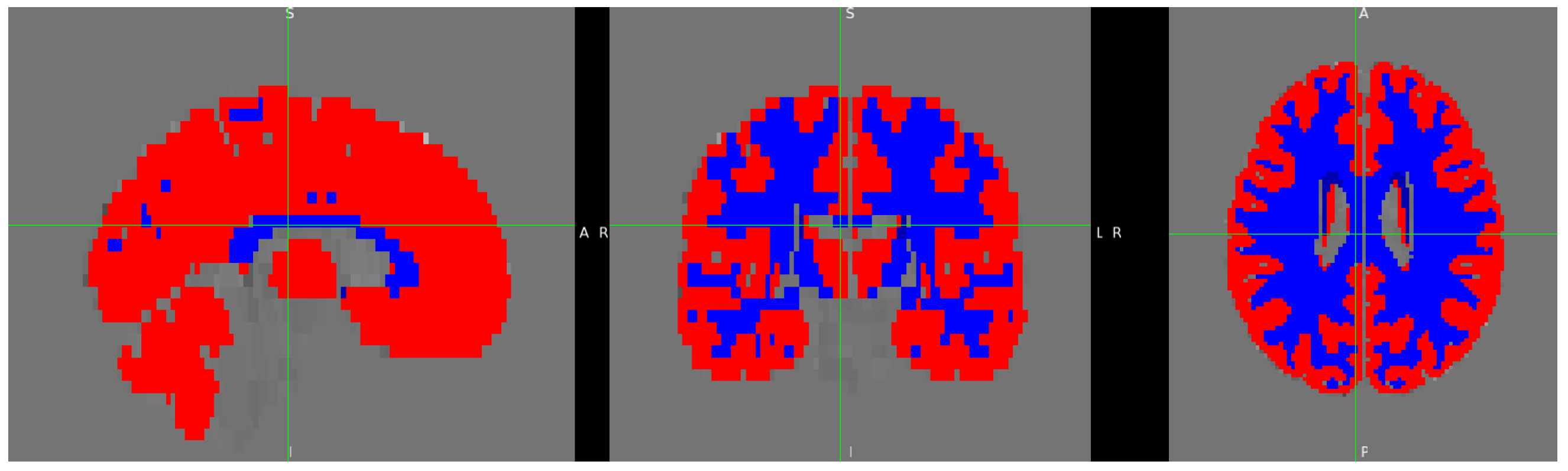 Entropy 26 00081 g002