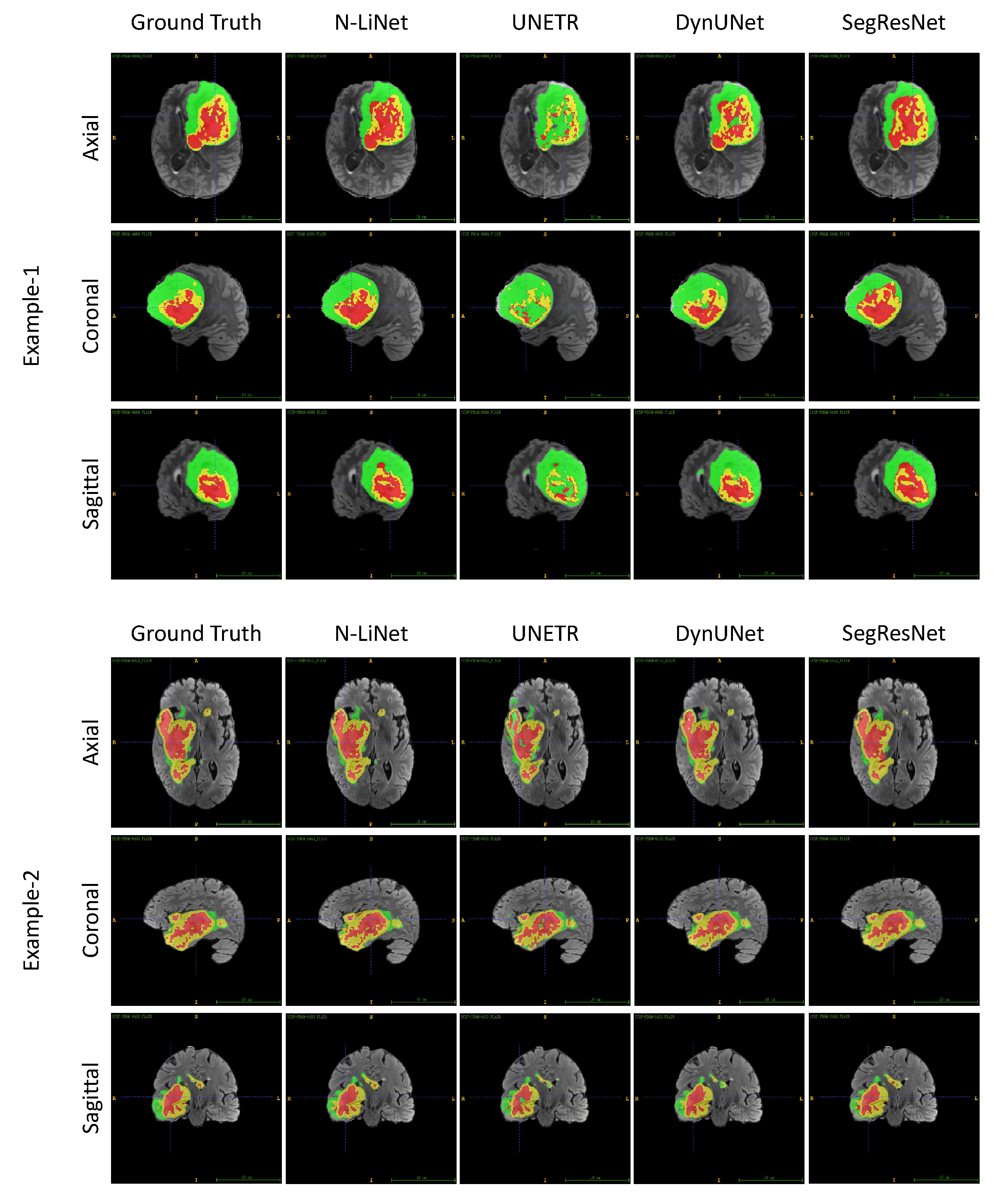 Entropy 26 00166 g007