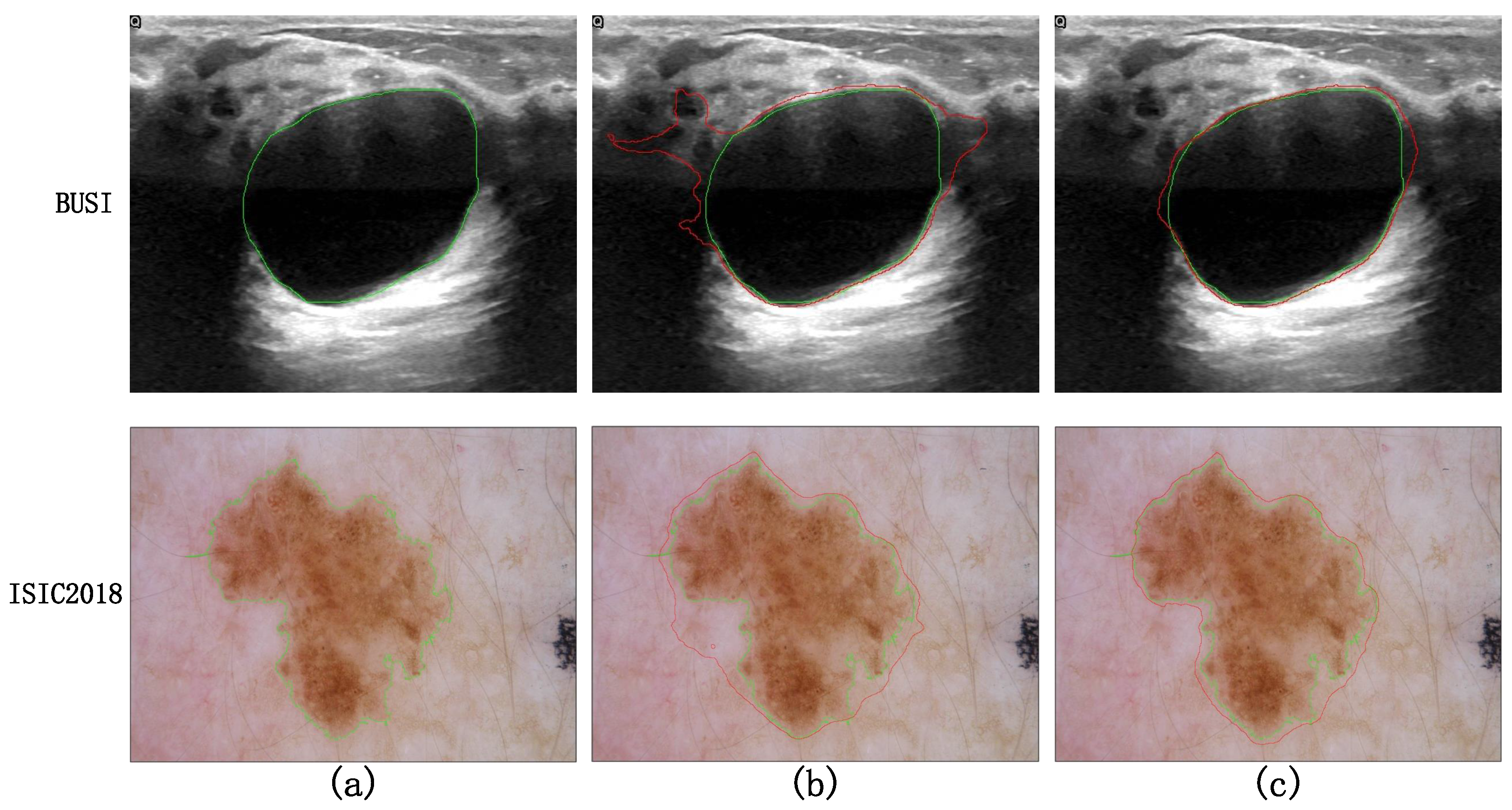 Entropy 26 00284 g011