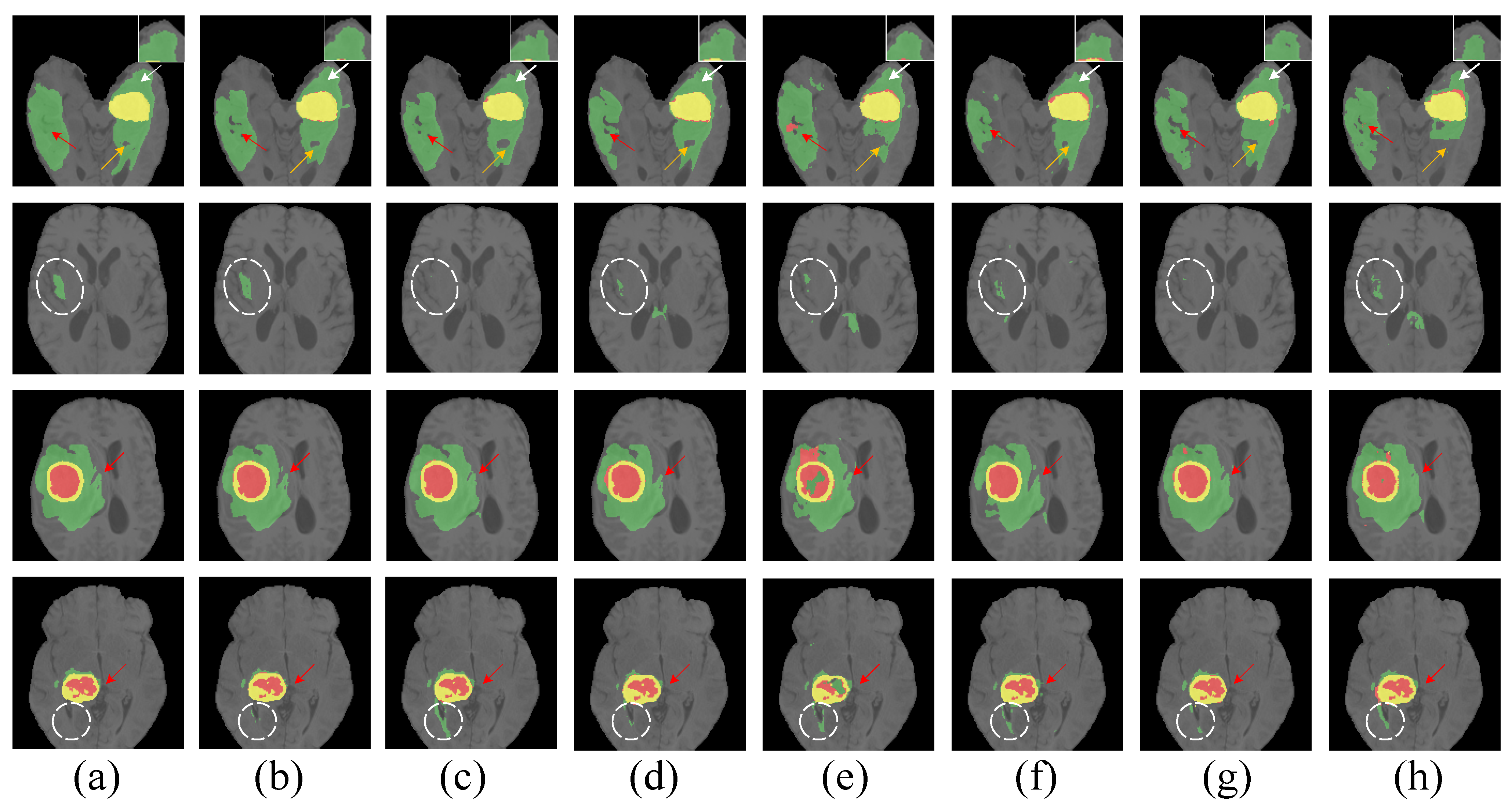 Entropy 26 00385 g011