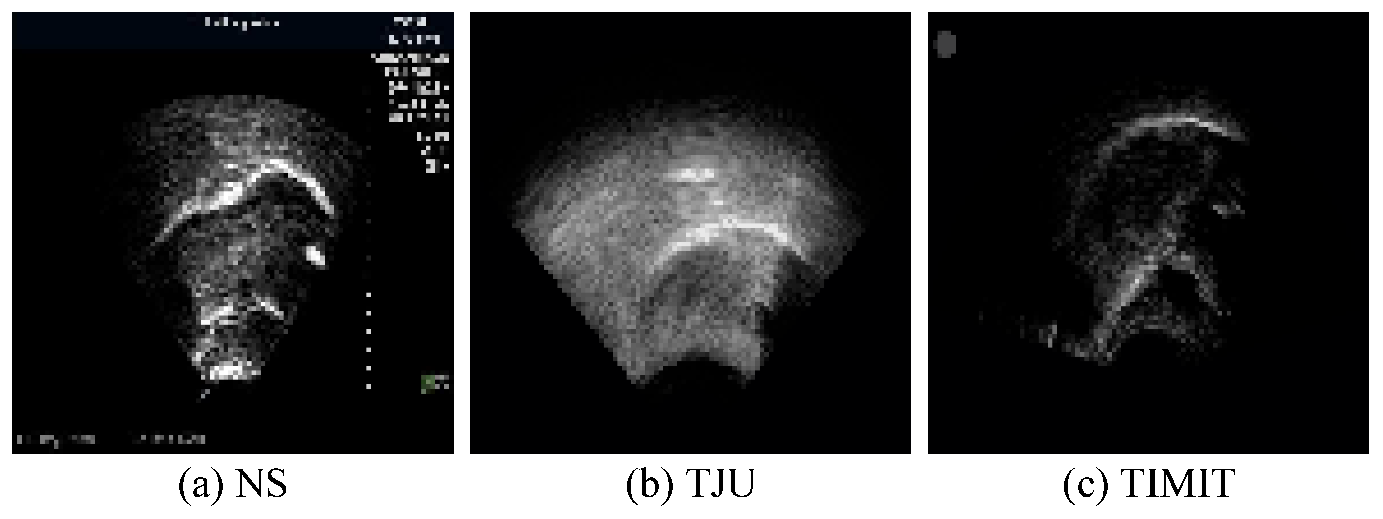 Entropy 26 00482 g007