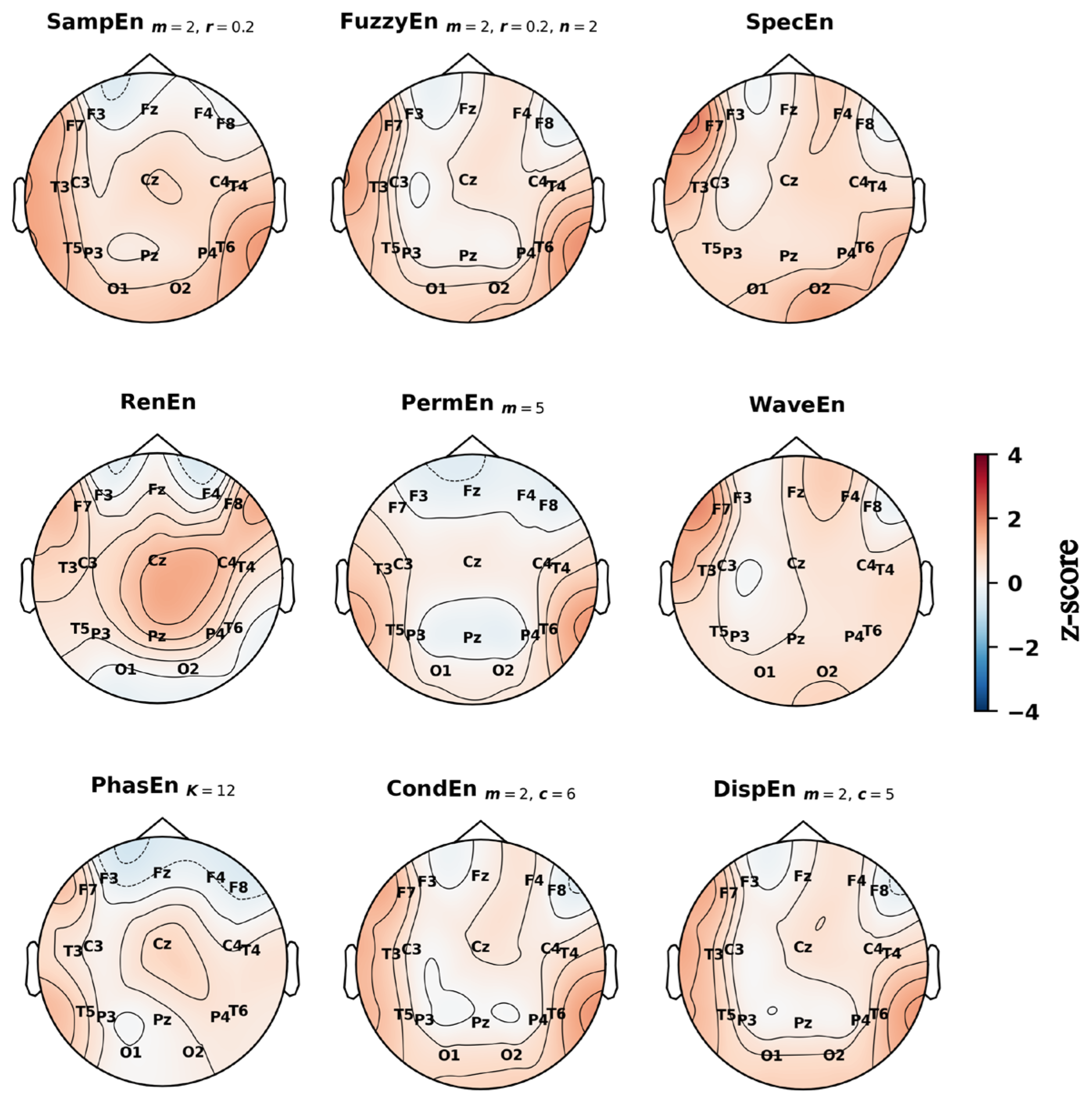 Entropy 27 01044 g005
