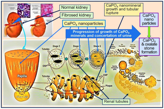 Environments Free Full Text Factors Affecting The Environmentally Induced Chronic Kidney Disease Of Unknown Aetiology In Dry Zonal Regions In Tropical Countries Novel Findings Html