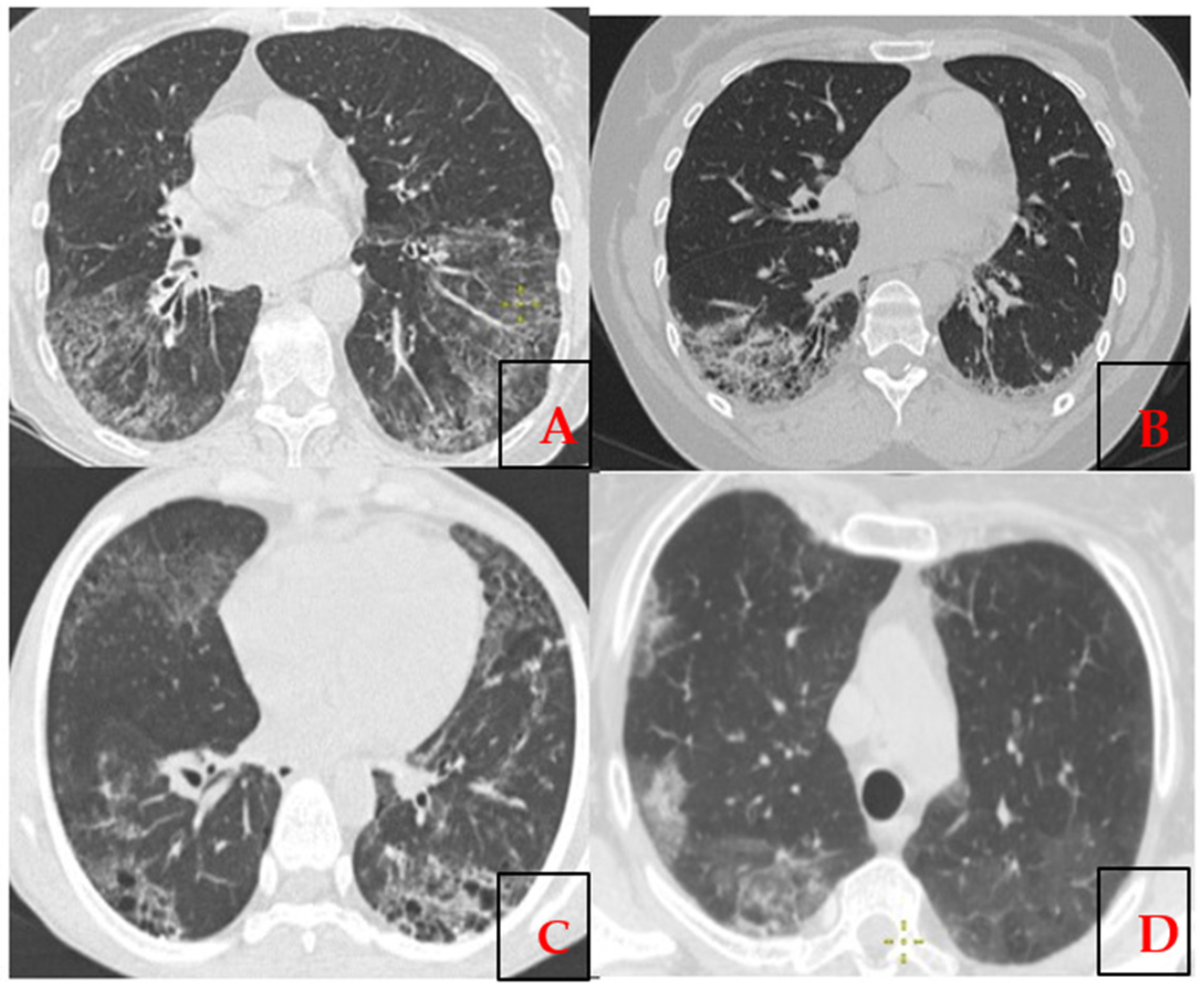 Epidemiologia 06 00041 g001