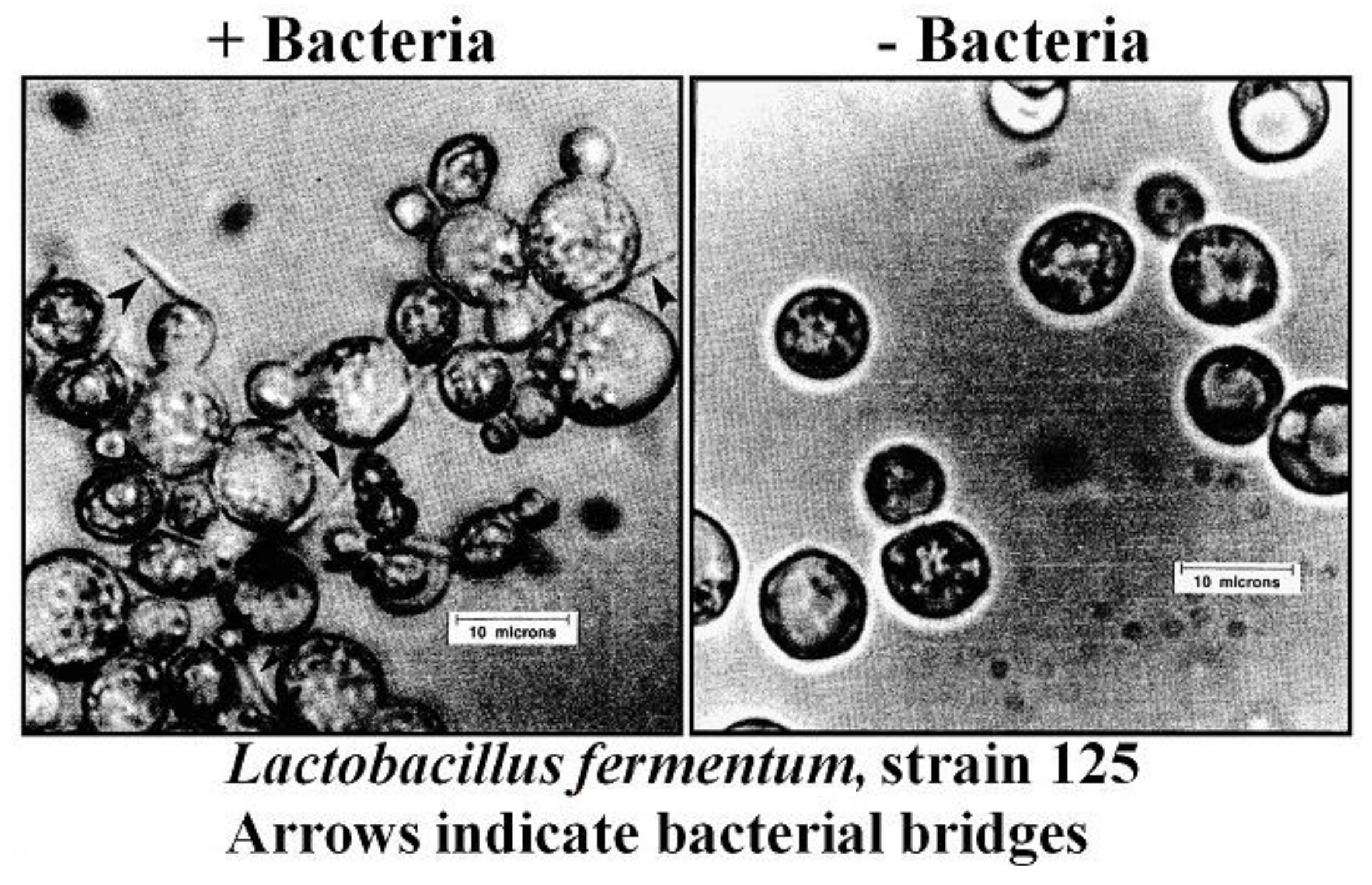 Fermentation 04 00028 g011