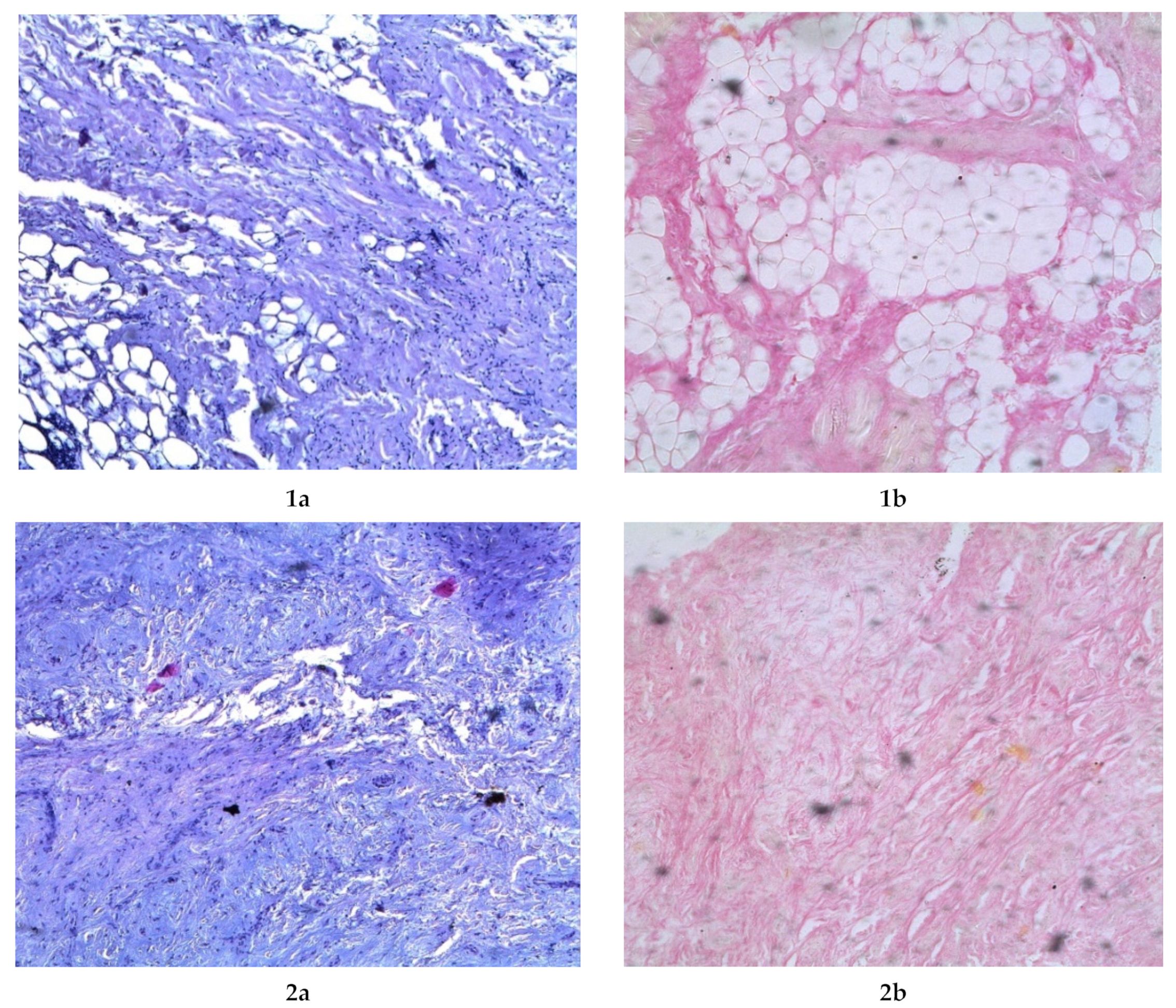 Fermentation 08 00056 g006a 550