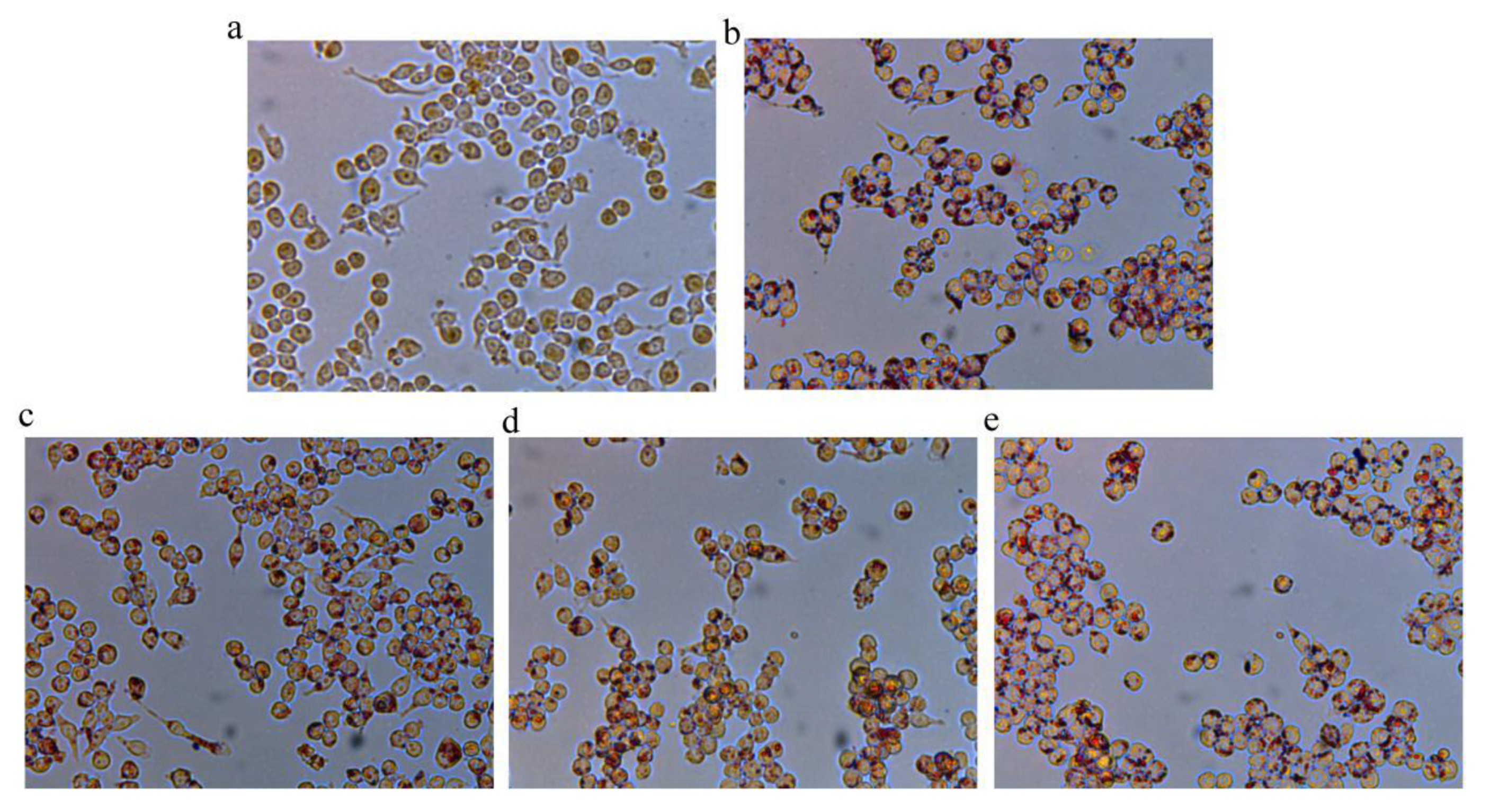 Changes in Phenolic Profiles and Inhibition Potential of