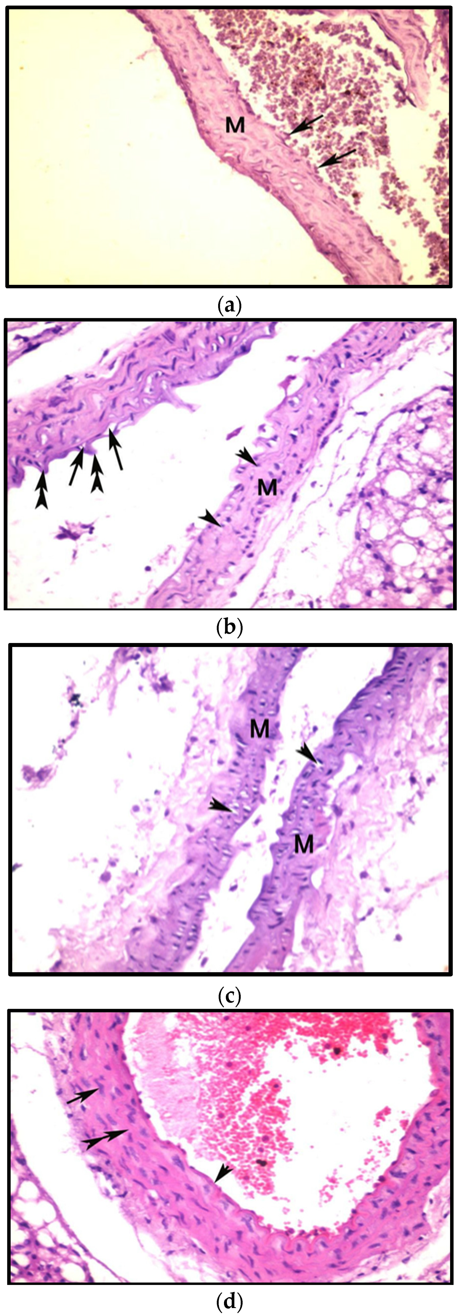 Fermentation 08 00220 g008a