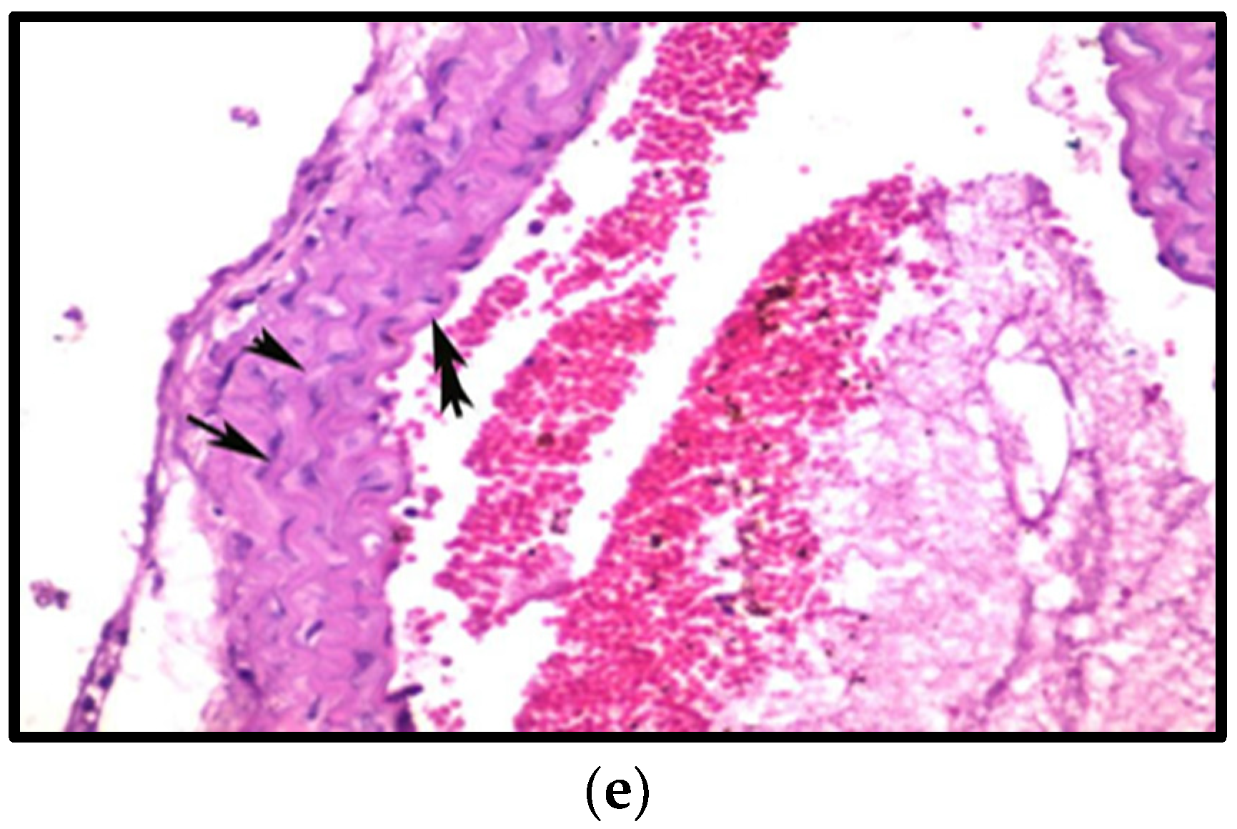 Fermentation 08 00220 g008b