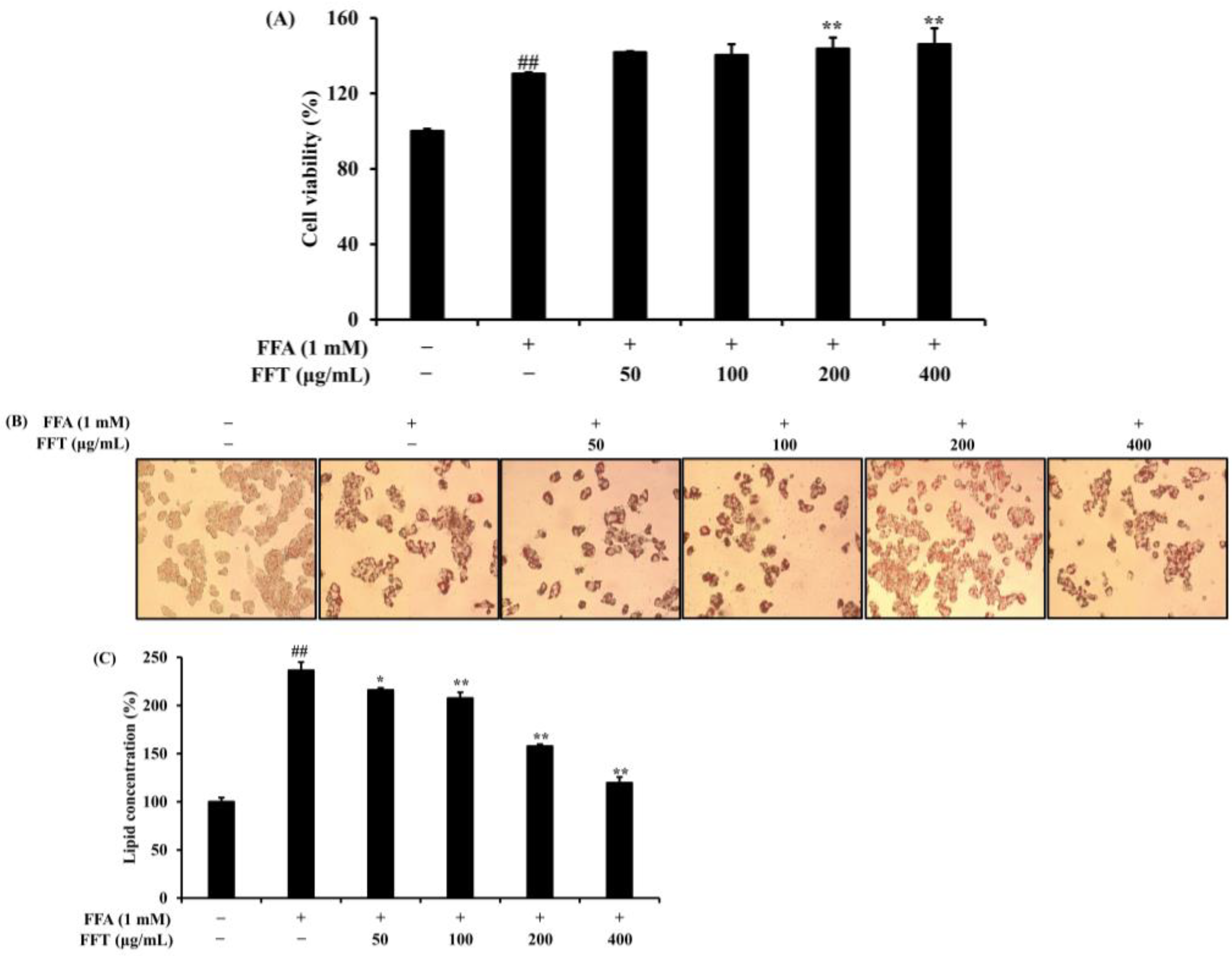 Enhanced AntiInflammatory and NonAlcoholic Fatty Liver Disease (NAFLD