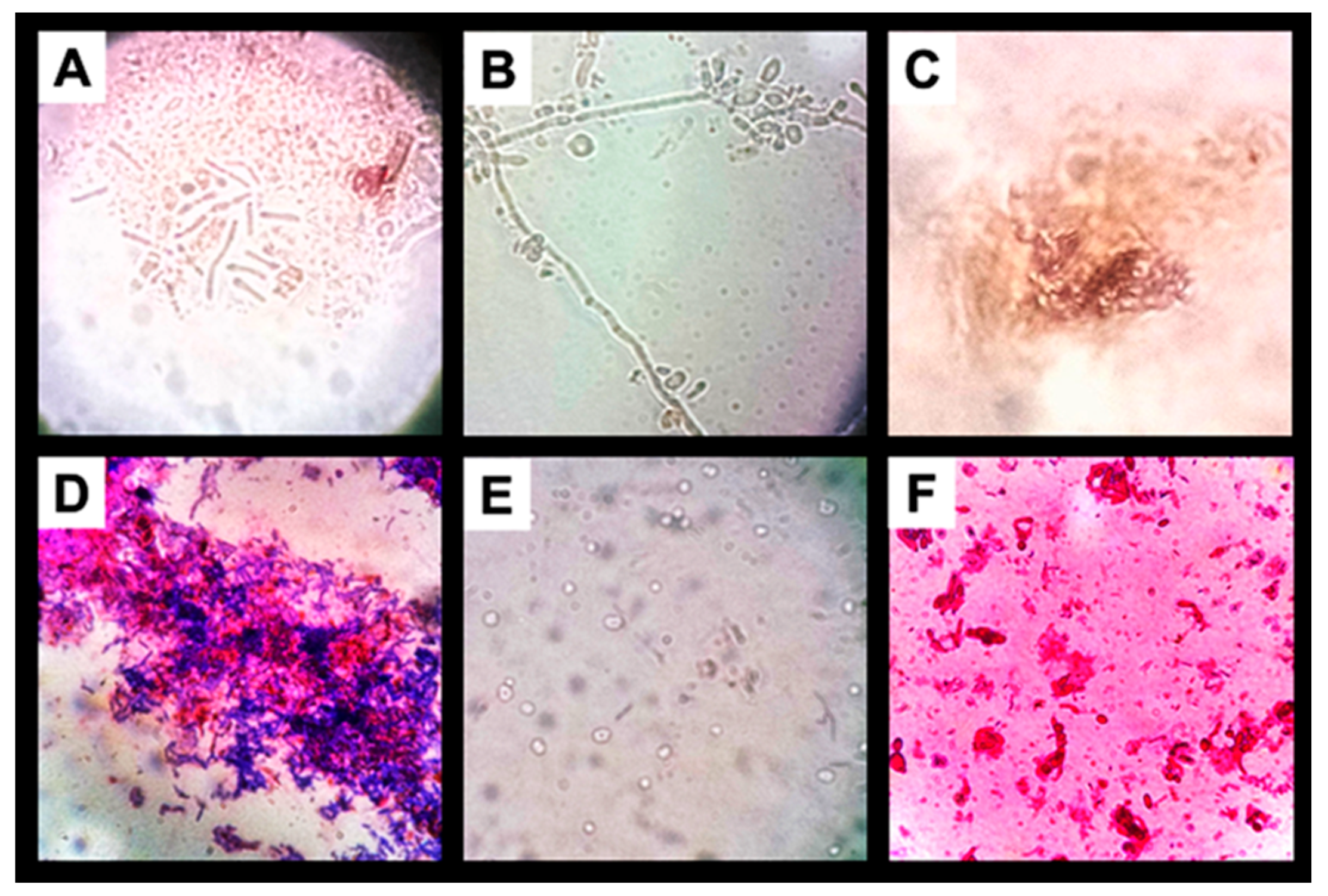 Fermentation 10 00586 g005