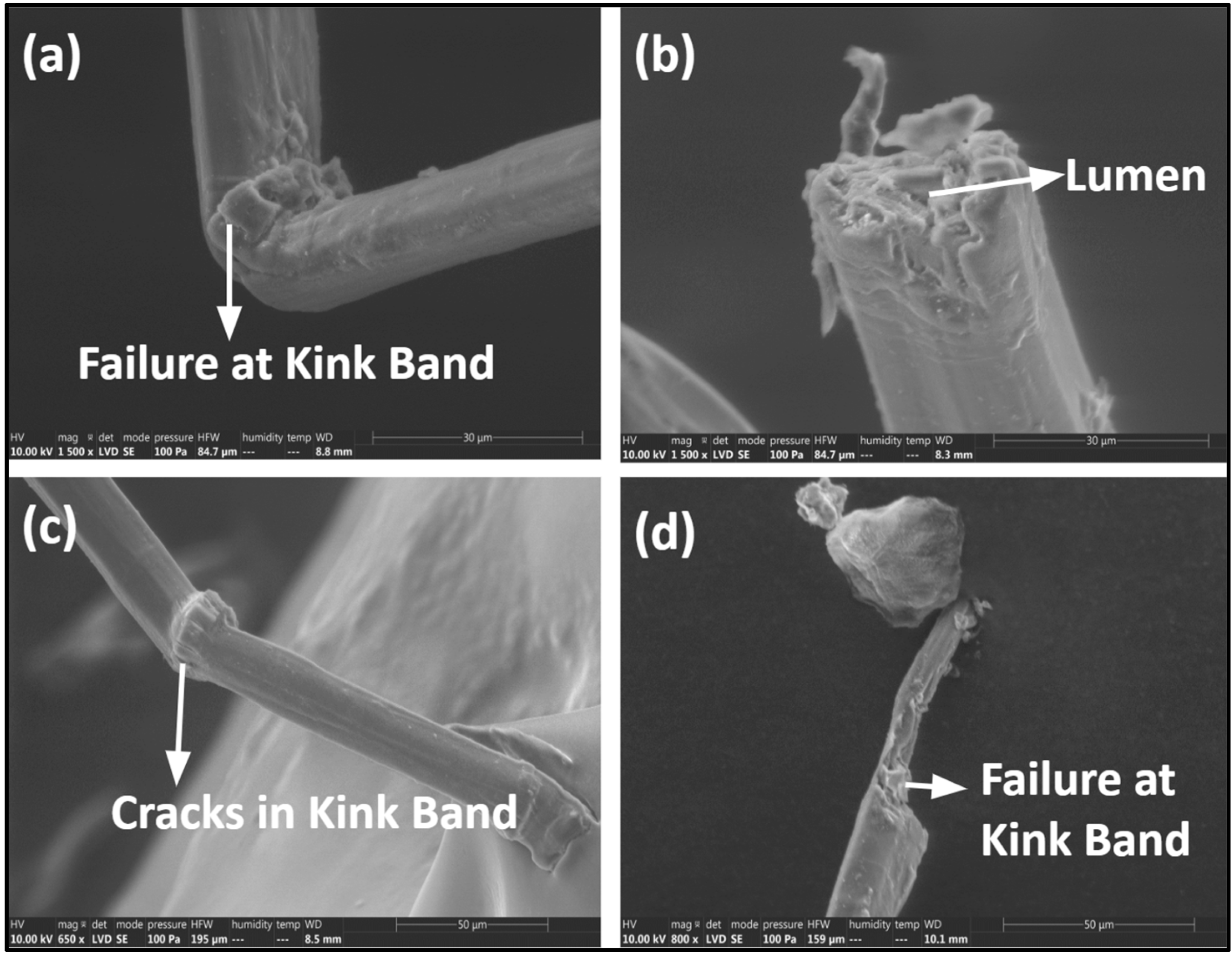 Impact of Defects on Tensile Properties of Ancient and Modern Egyptian ...