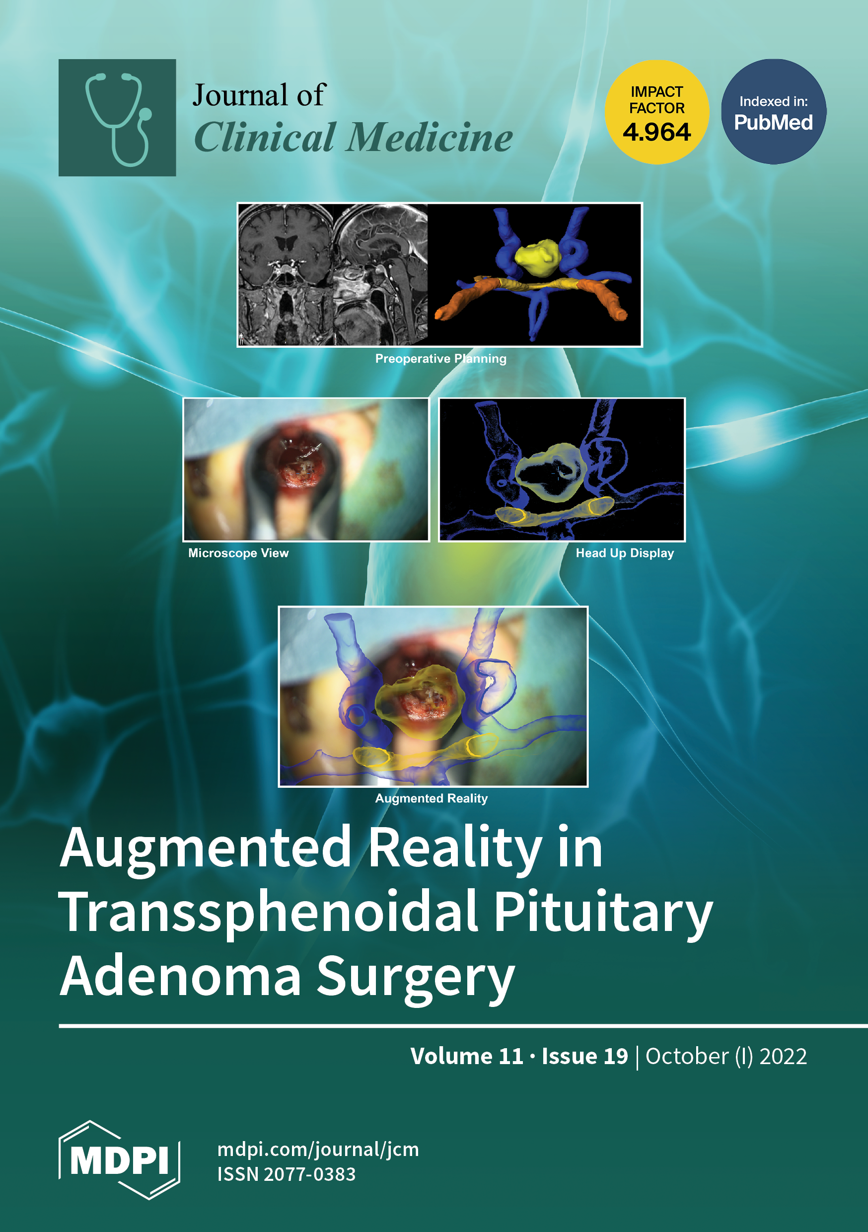 Association of increased morbidity with the occurrence of hyperglycemia in  the immediate postoperative period after elective pediatric neurosurgery  in: Journal of Neurosurgery: Pediatrics Volume 17 Issue 5 (2016) Journals