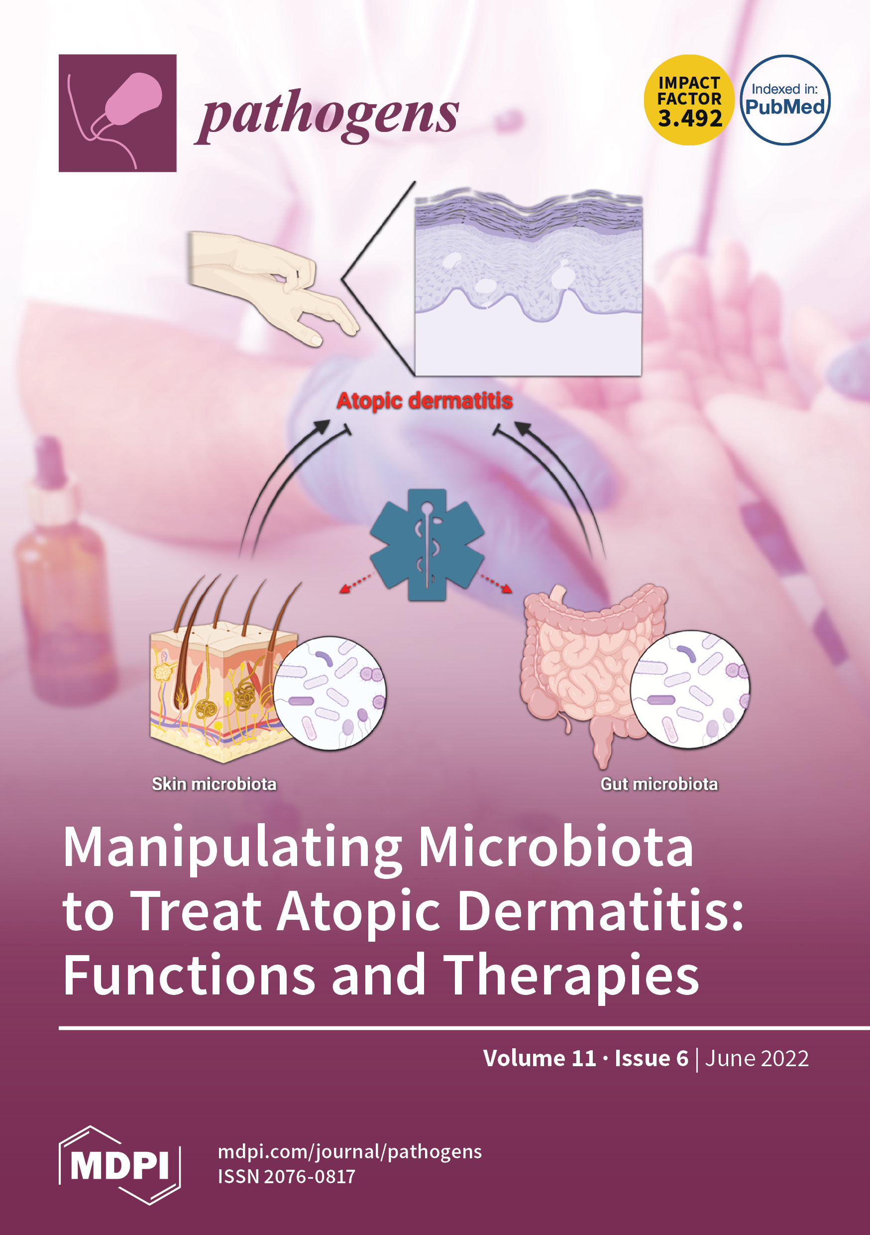 https://www.mdpi.com/files/uploaded/covers/pathogens/big_cover-pathogens-v11-i6.png