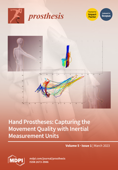 Lower Limb Prosthesis 101: Knowledge is Power