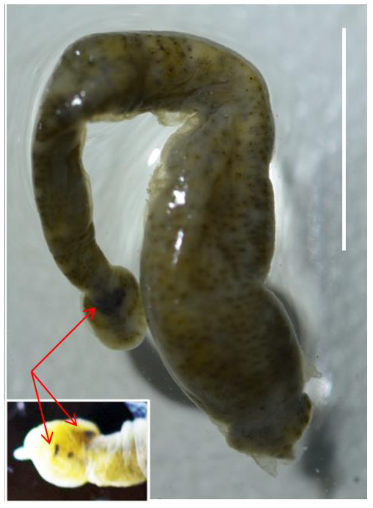 White Strings In Stool