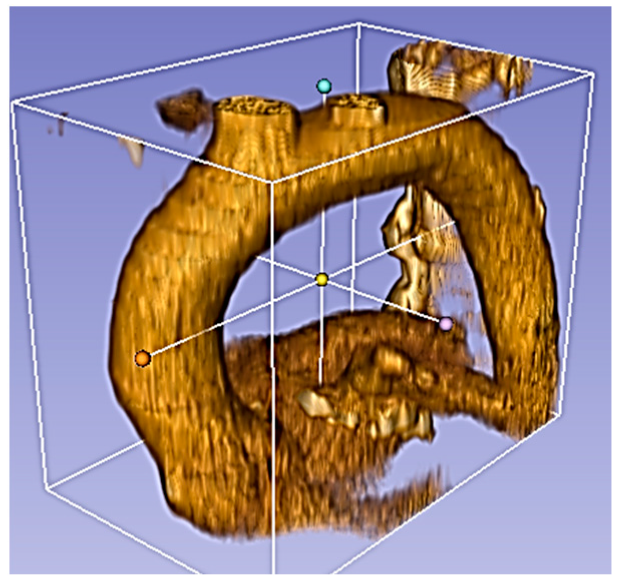 Fluids 02 00031 g001