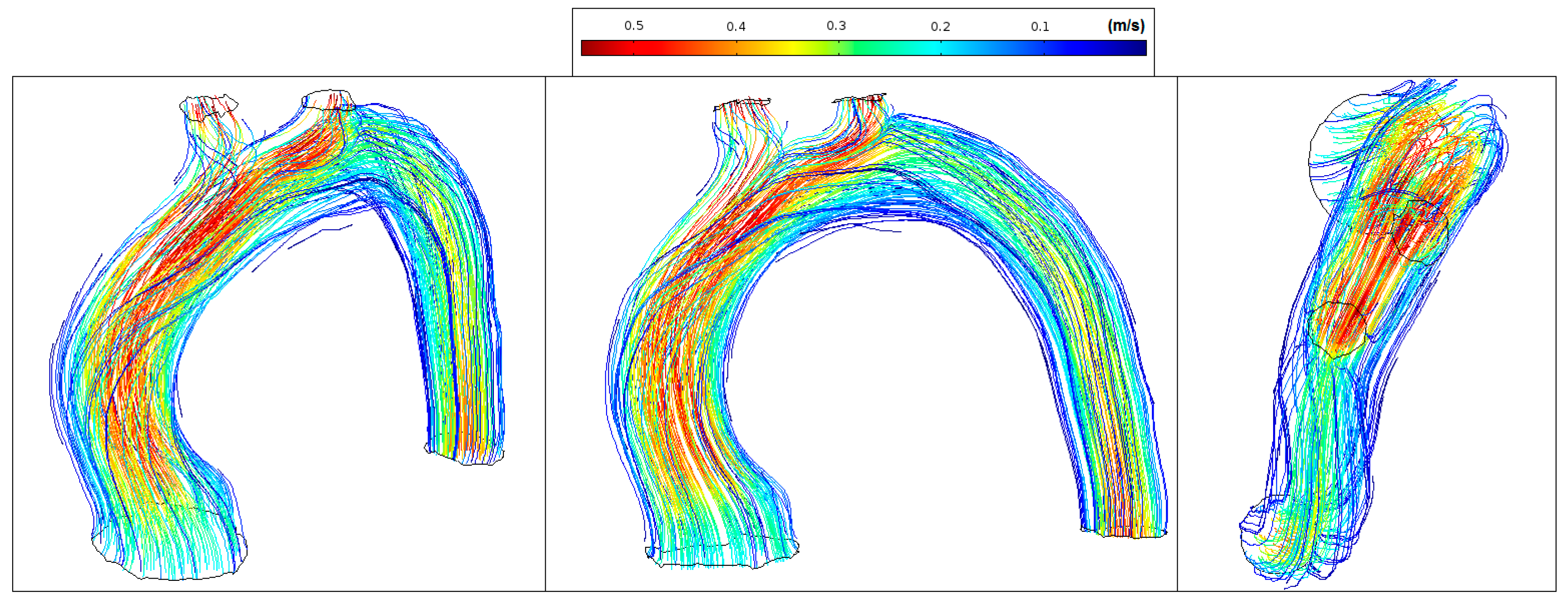 Fluids 02 00031 g011