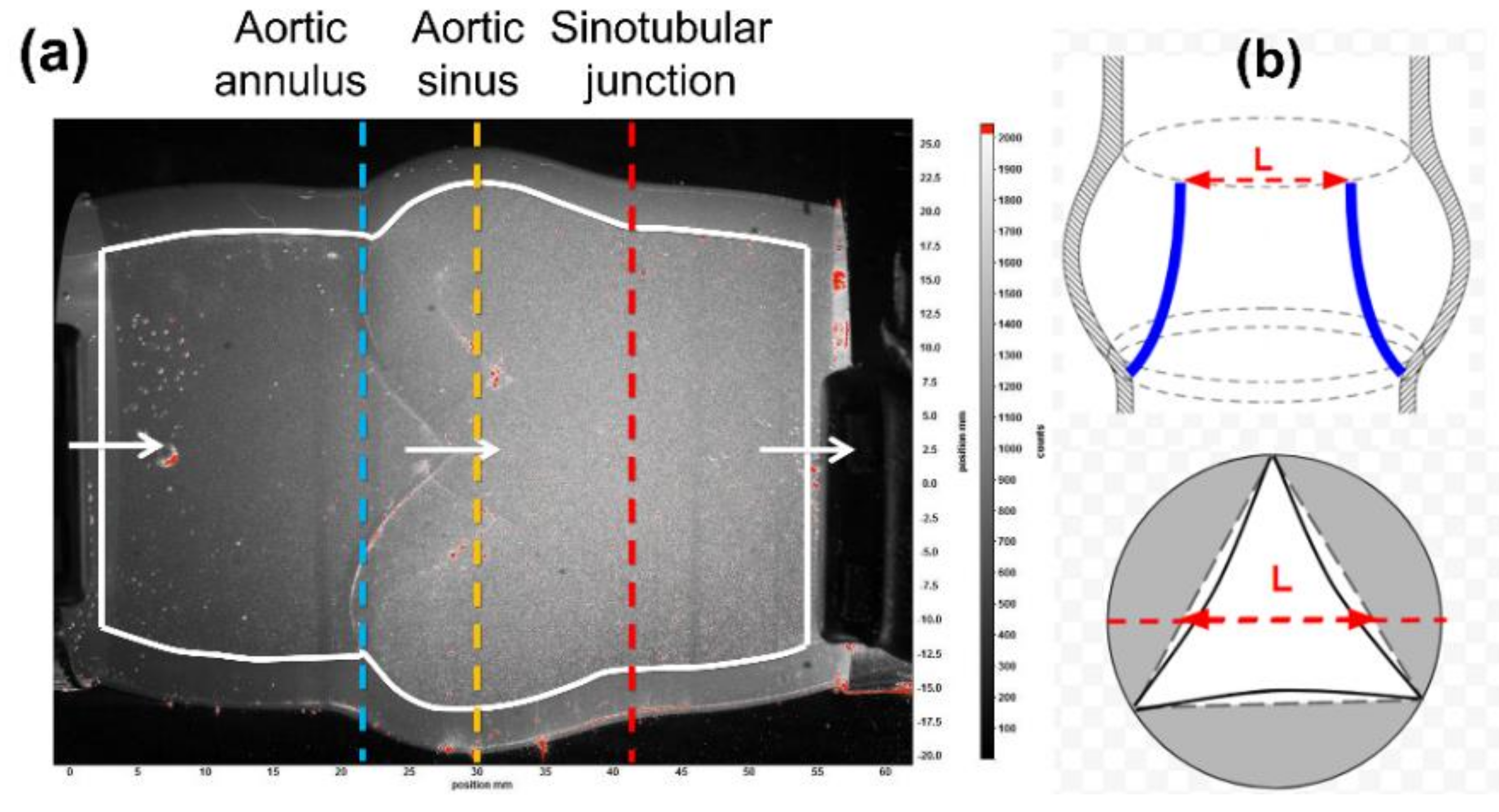 Fluids 03 00071 g003 Fluids 03 00071 g003