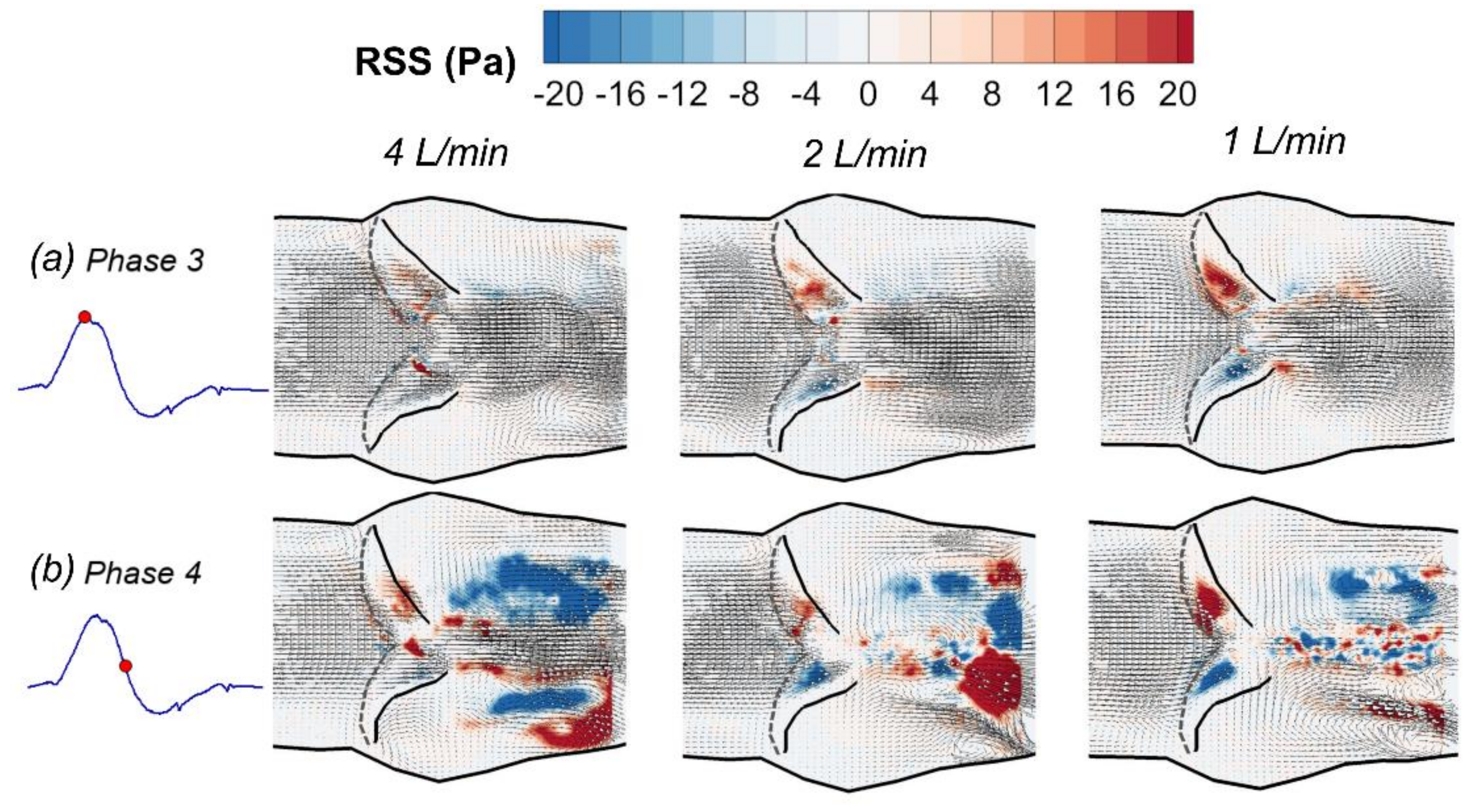 Fluids 03 00071 g010 Fluids 03 00071 g010